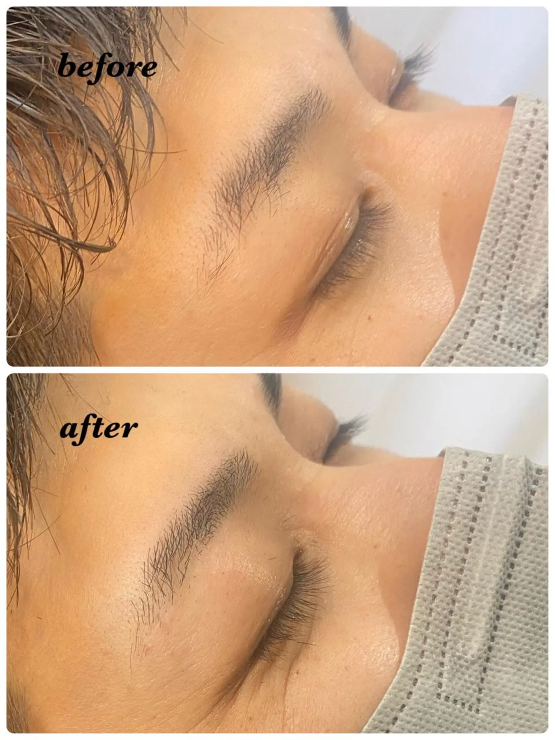 アイブロウ ハーブピーリング/韓国肌管理/フェイシャル/毛穴洗浄/眉毛/顔脱毛【糸脱毛専門】rev所属・ハーブピーリング🌹 毛穴洗浄❤️眉waxのエステ・リラクイメージ