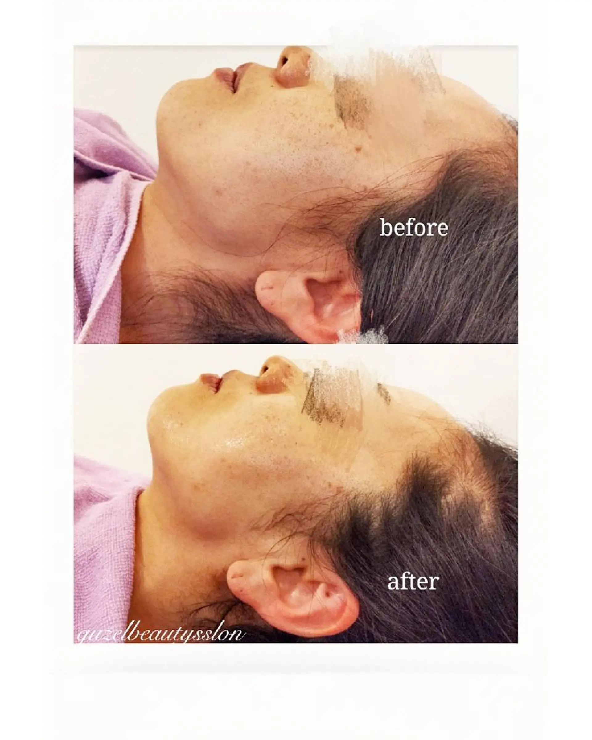 🅖🅤🅩🅔🅛 salonのエステ・リラクイメージ