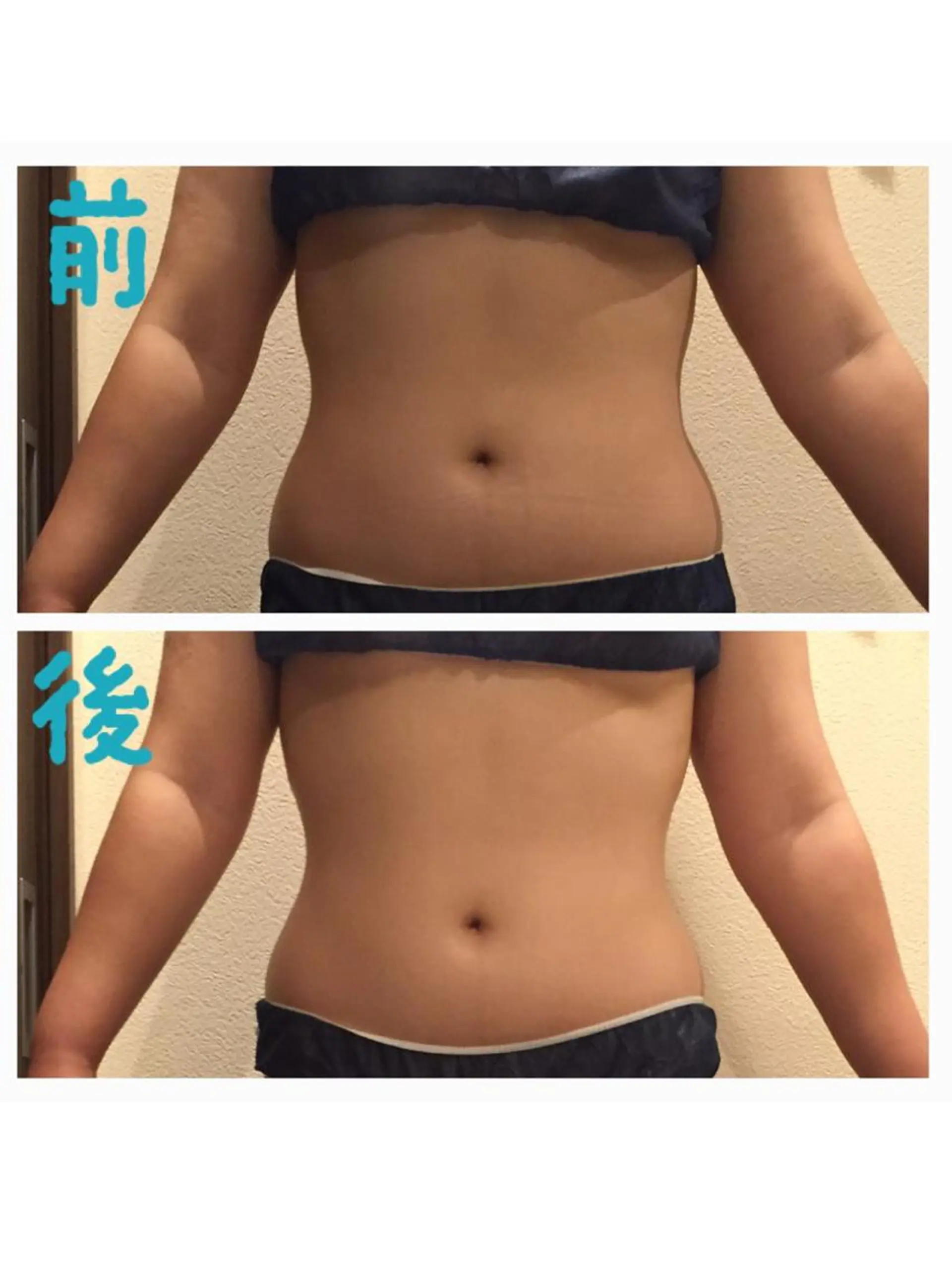 エステ リラク 毒素出し専門サロンSylph(なかがわ整骨院併設サロン)所属・Mami Hataのエステ・リラクイメージ