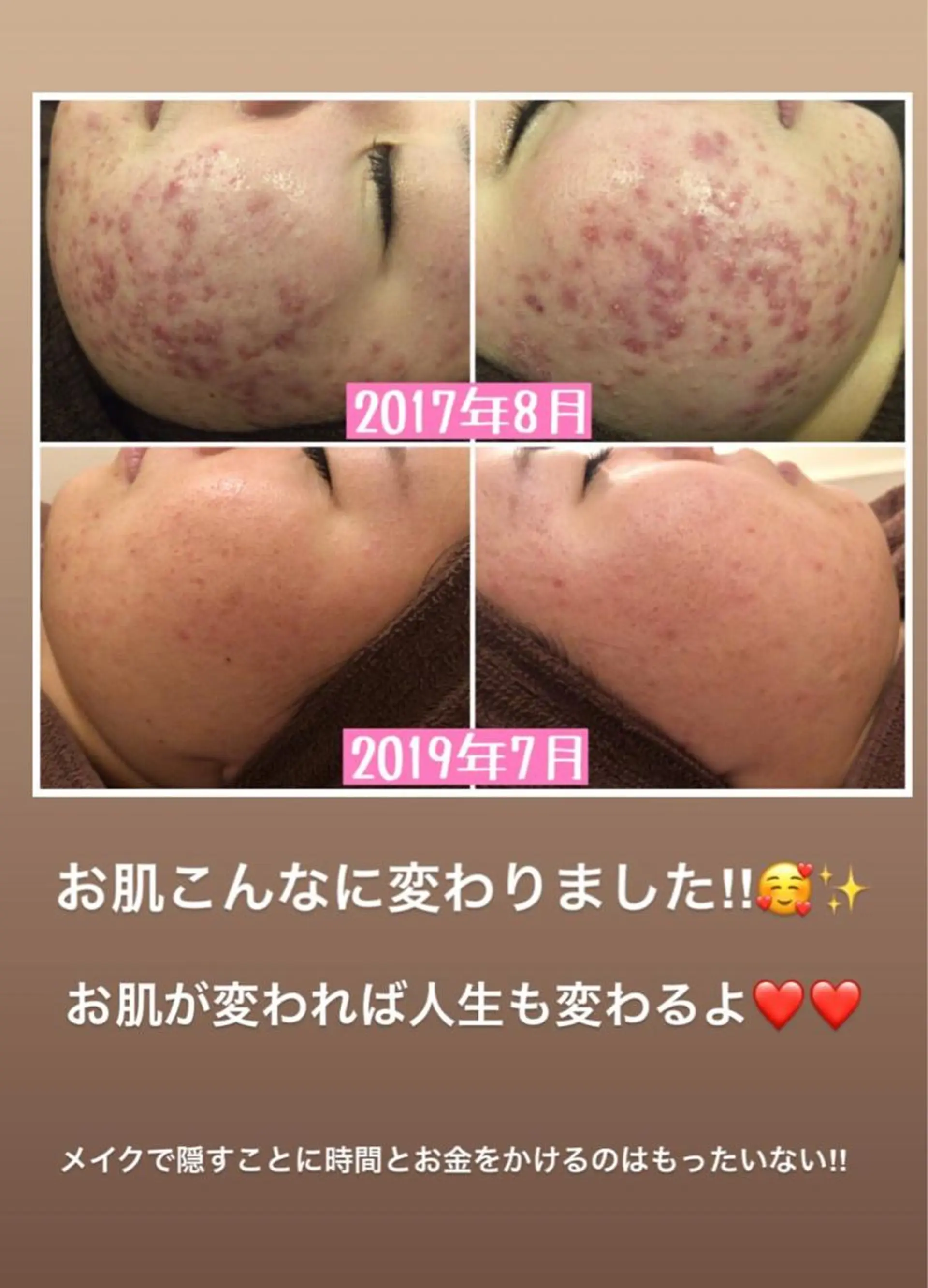 ミディアム カラー パーマ ヘアアレンジ メンズ キッズ ネイル マツエク・マツパ エステ リラク ニキビ・肌質改善専門 ♡人生が変わるサロンのエステ・リラクイメージ