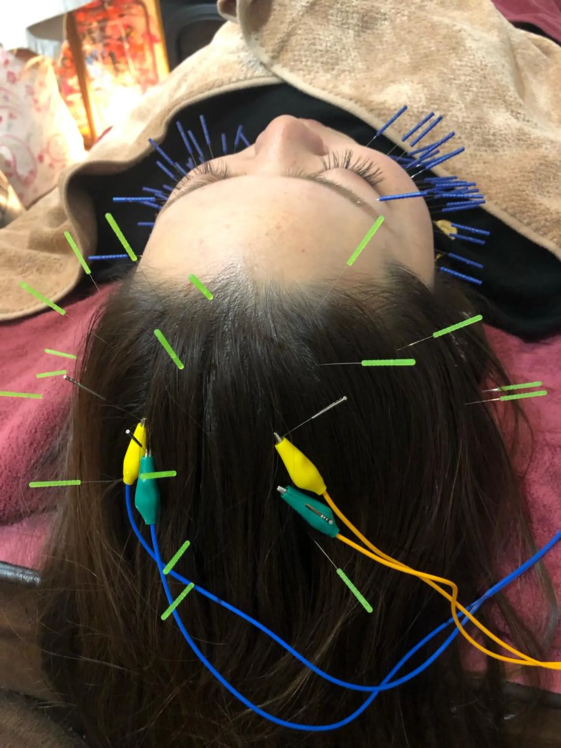 美容鍼灸女性専用 りんご鍼灸治療院のエステ・リラクイメージ