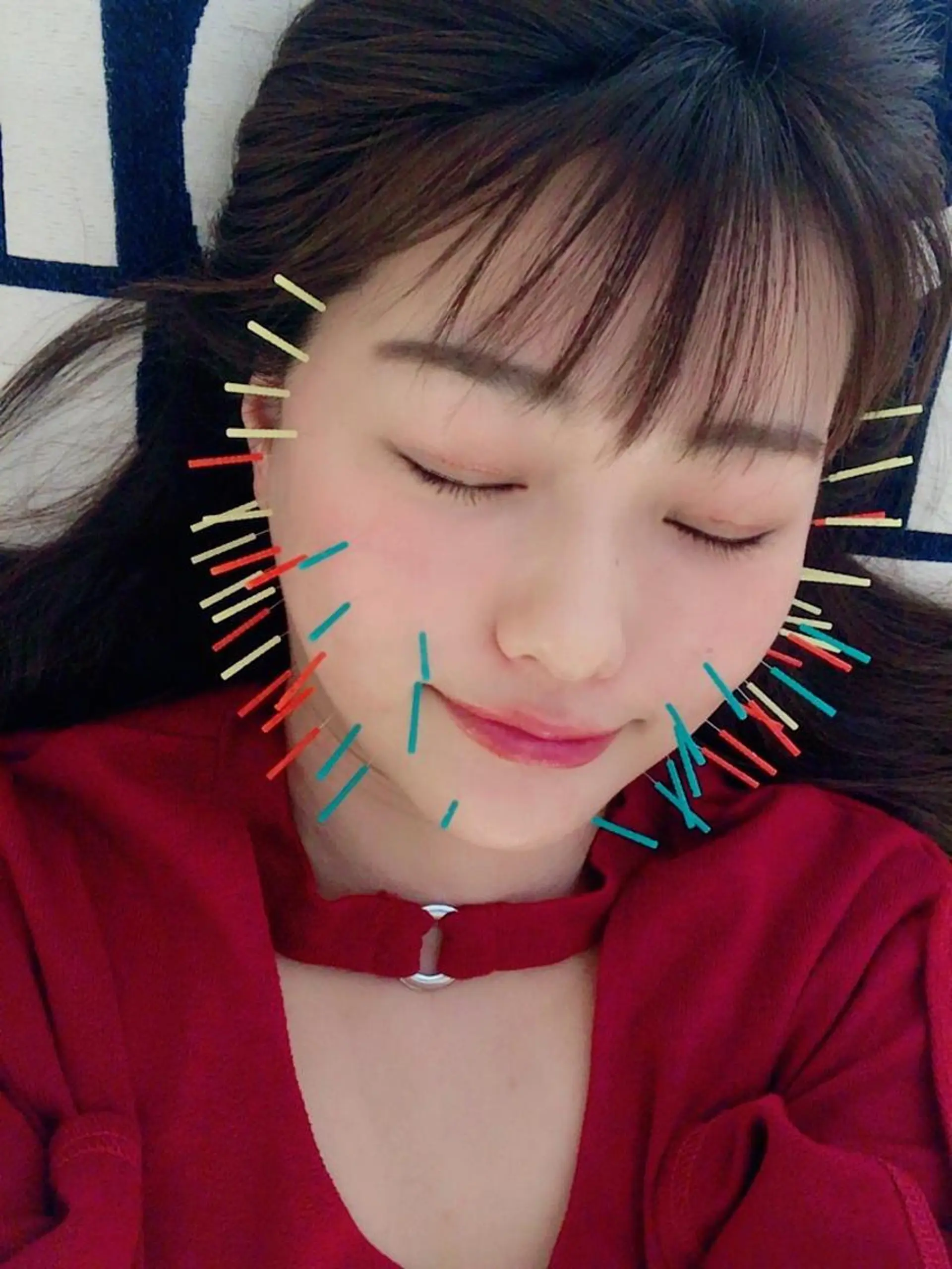 鍼灸整骨院Refine所属・鍼灸 Refineのその他イメージ