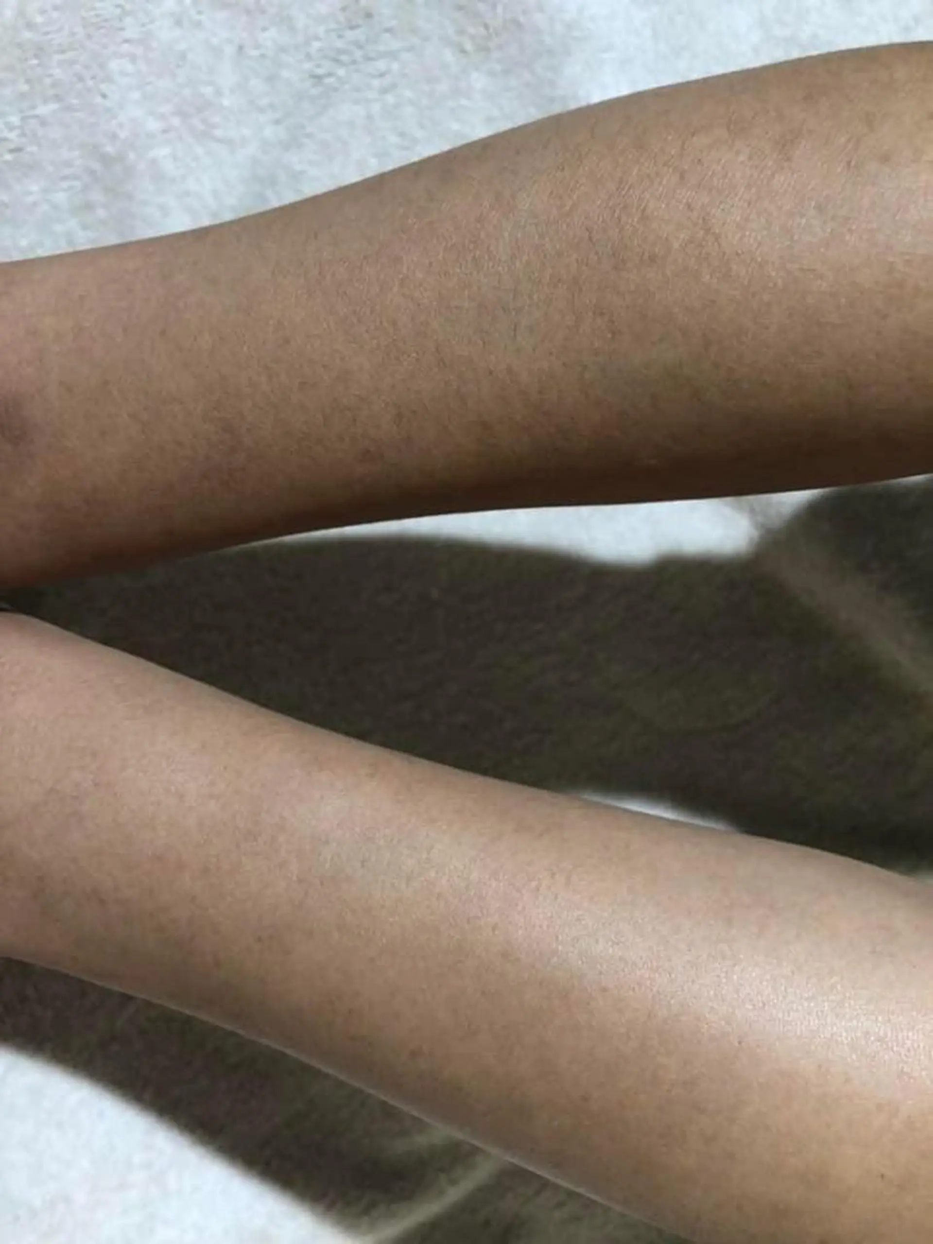 脱毛 仲澤 千春のエステ・リラクイメージ