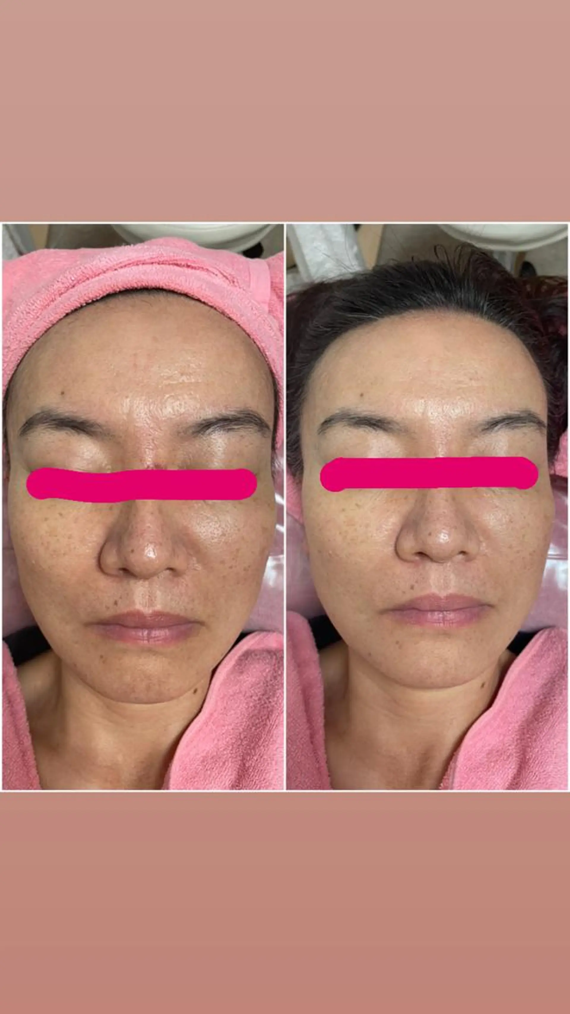 エステ リラク 透明感の肌Lino malieのエステ・リラクイメージ