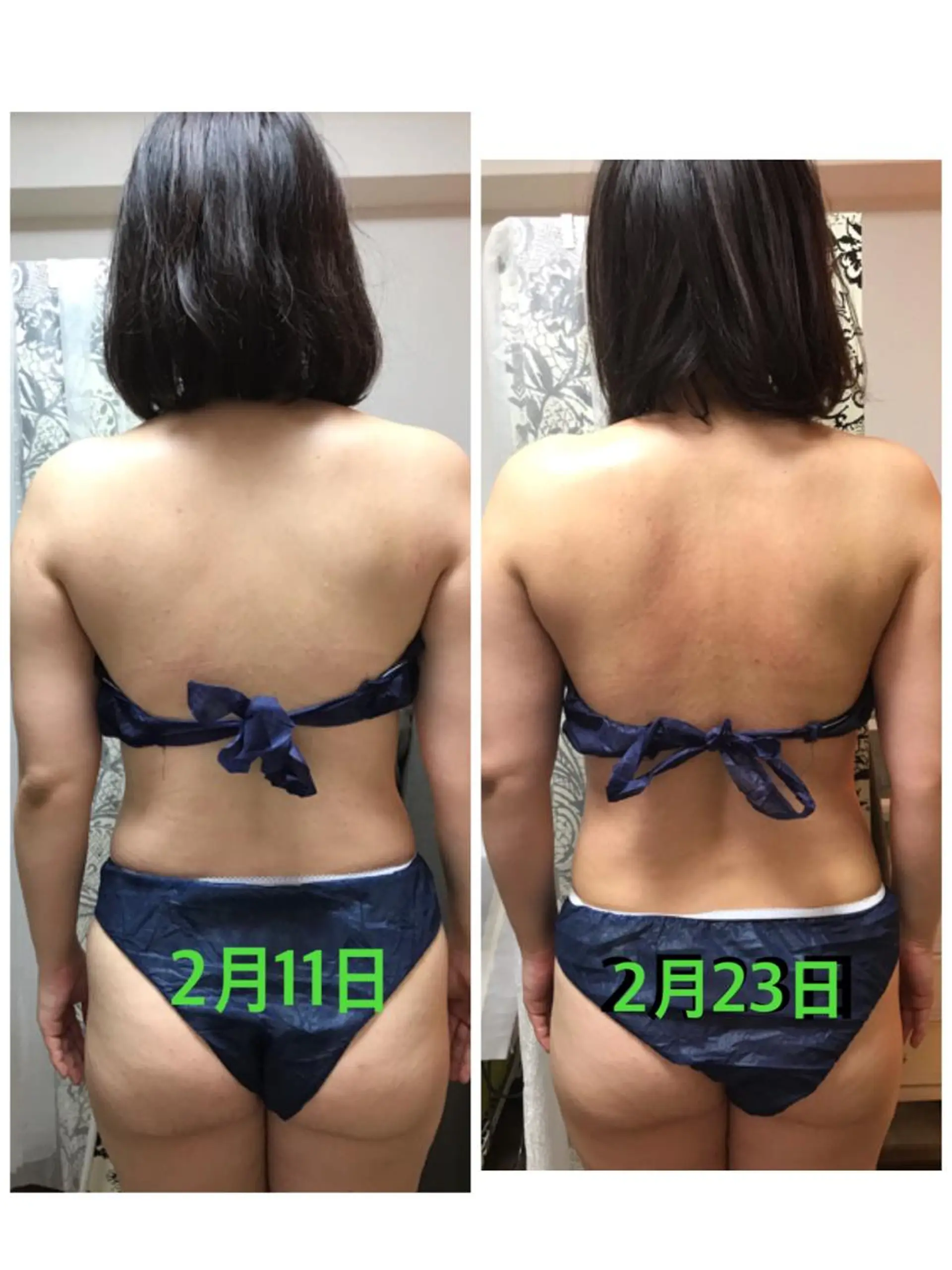 横浜ビューティーファクトリーHANA元町店所属・エステ&アロマ HANAのエステ・リラクイメージ