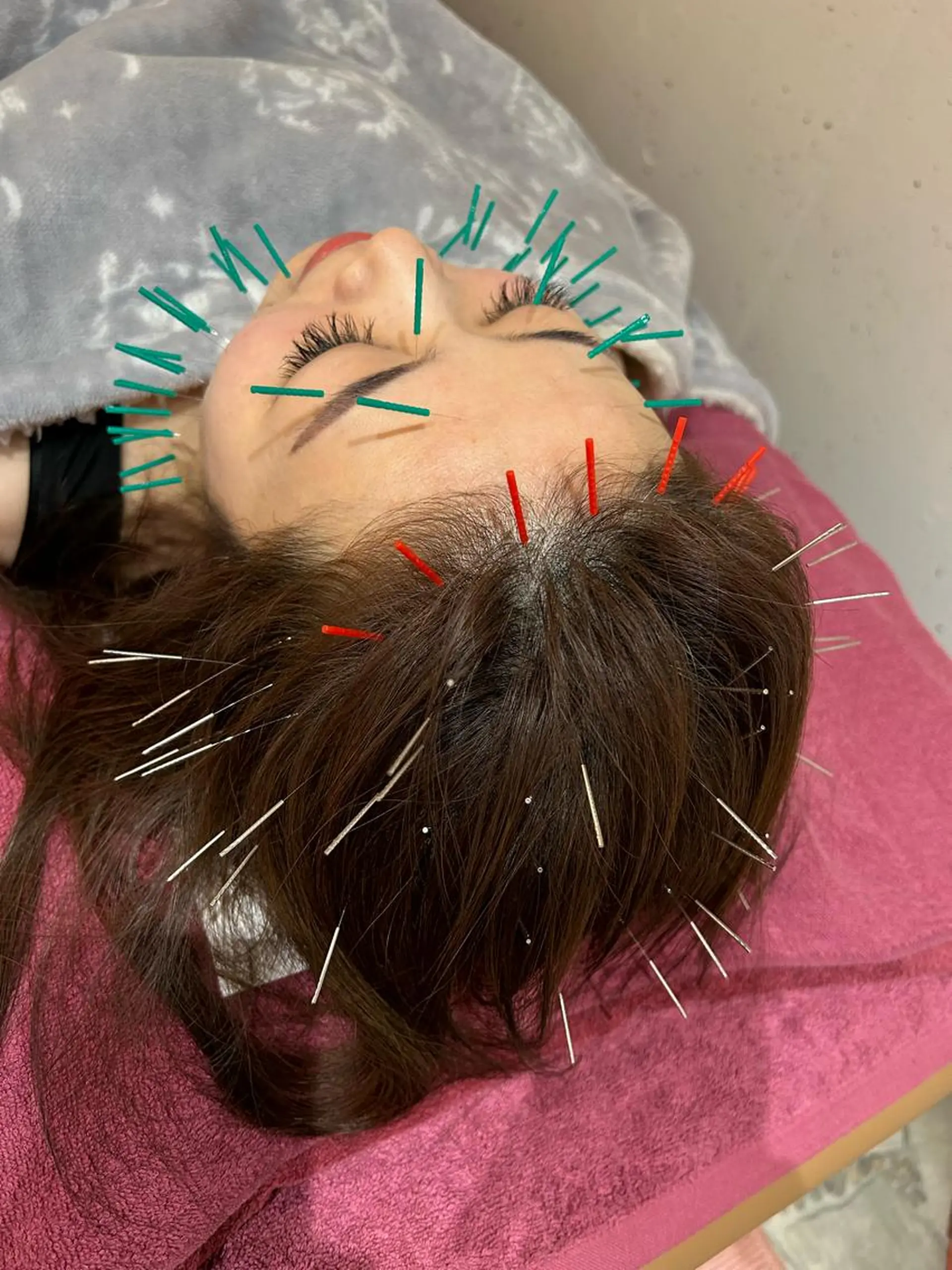 美容鍼灸女性専用 りんご鍼灸治療院のその他イメージ