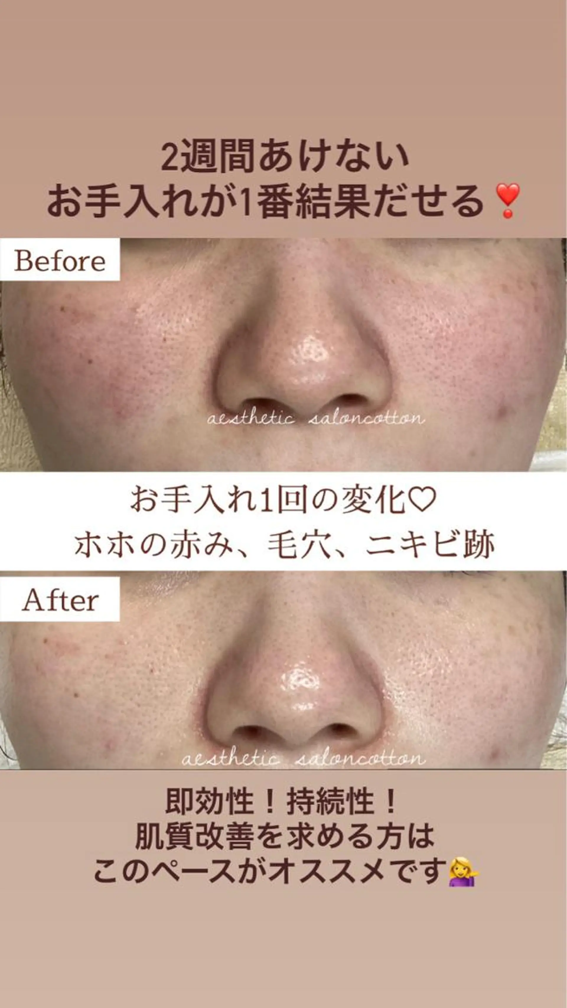 エステ 都度払い 肌質改善専門サロンのエステ・リラクイメージ