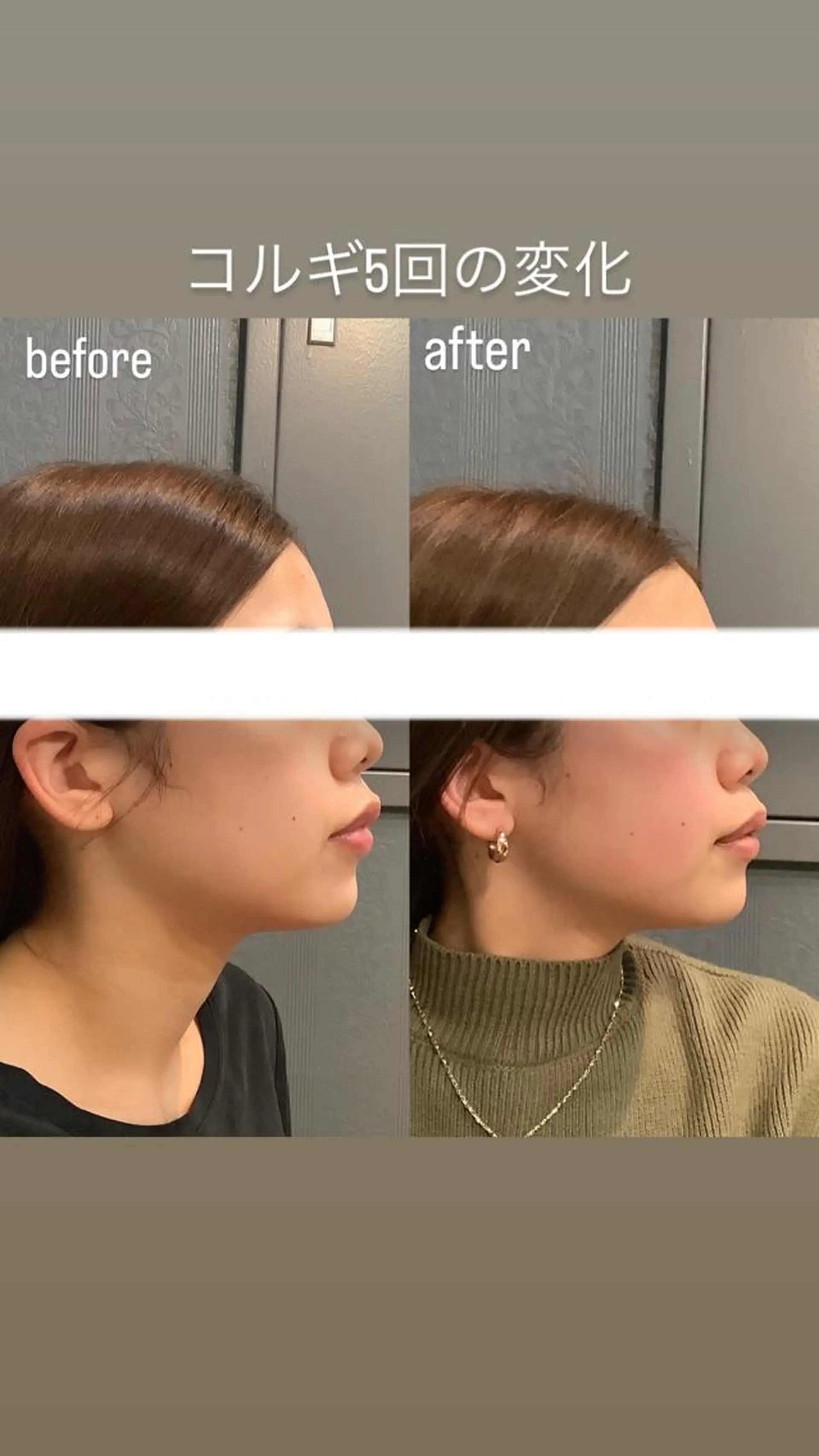 エステ リラク エステサロンino.colore'所属・小顔サロン ino.coloreのエステ・リラクイメージ