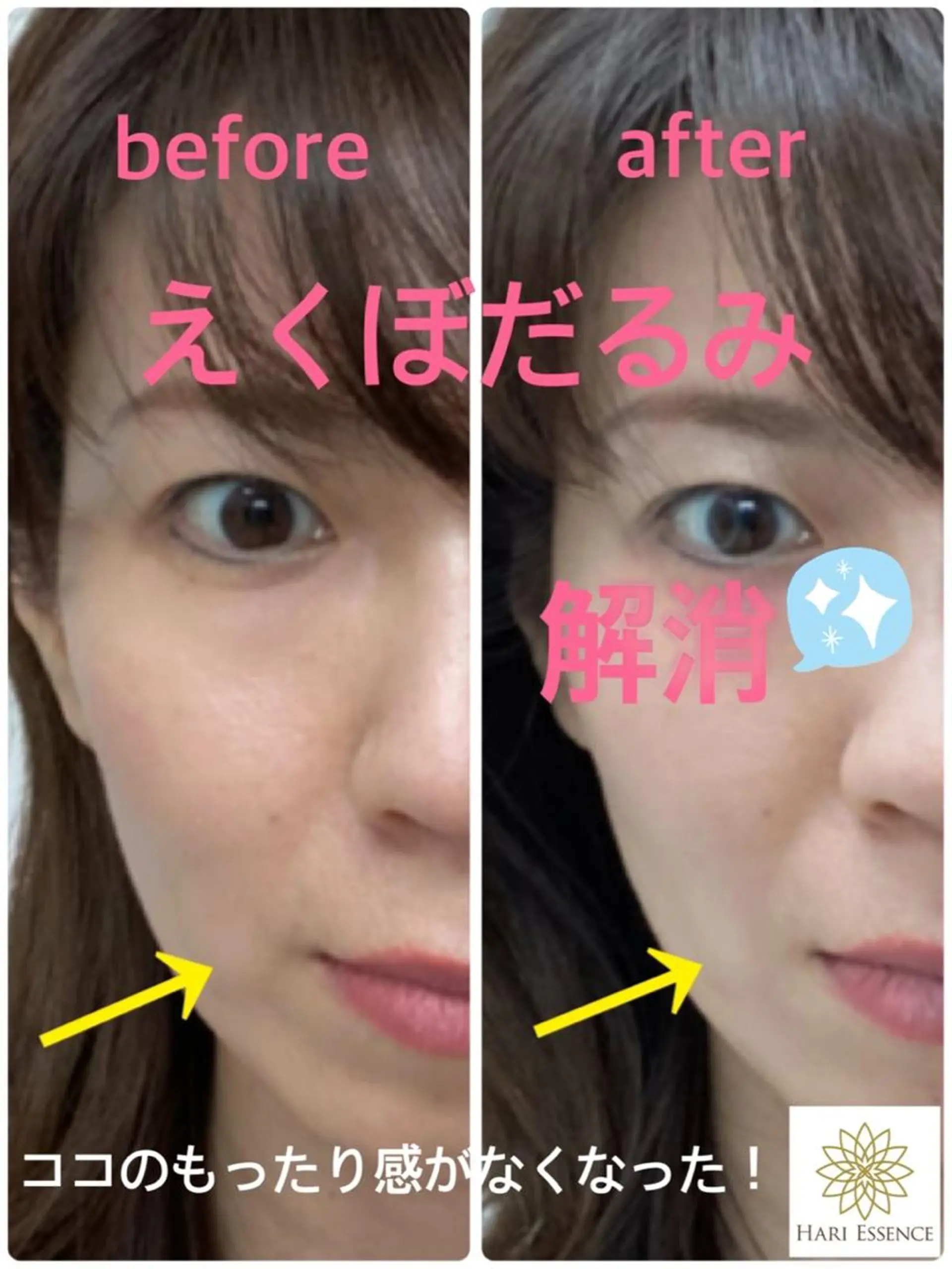 美容鍼灸専門院　ハリエッセンス所属・美容鍼専門鍼灸院 ハリエッセンスのその他イメージ