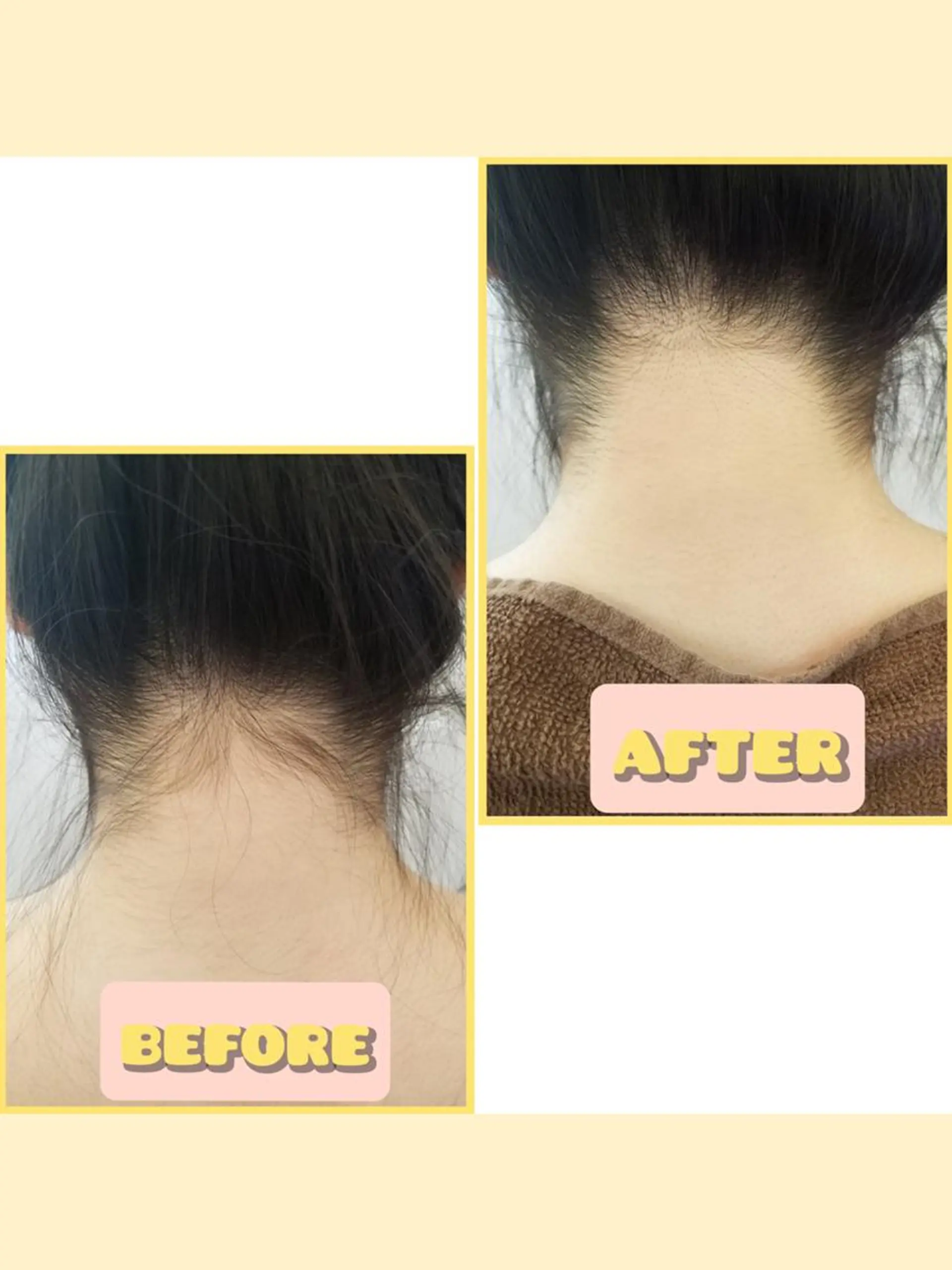 脱毛 salonde ReGodのエステ・リラクイメージ