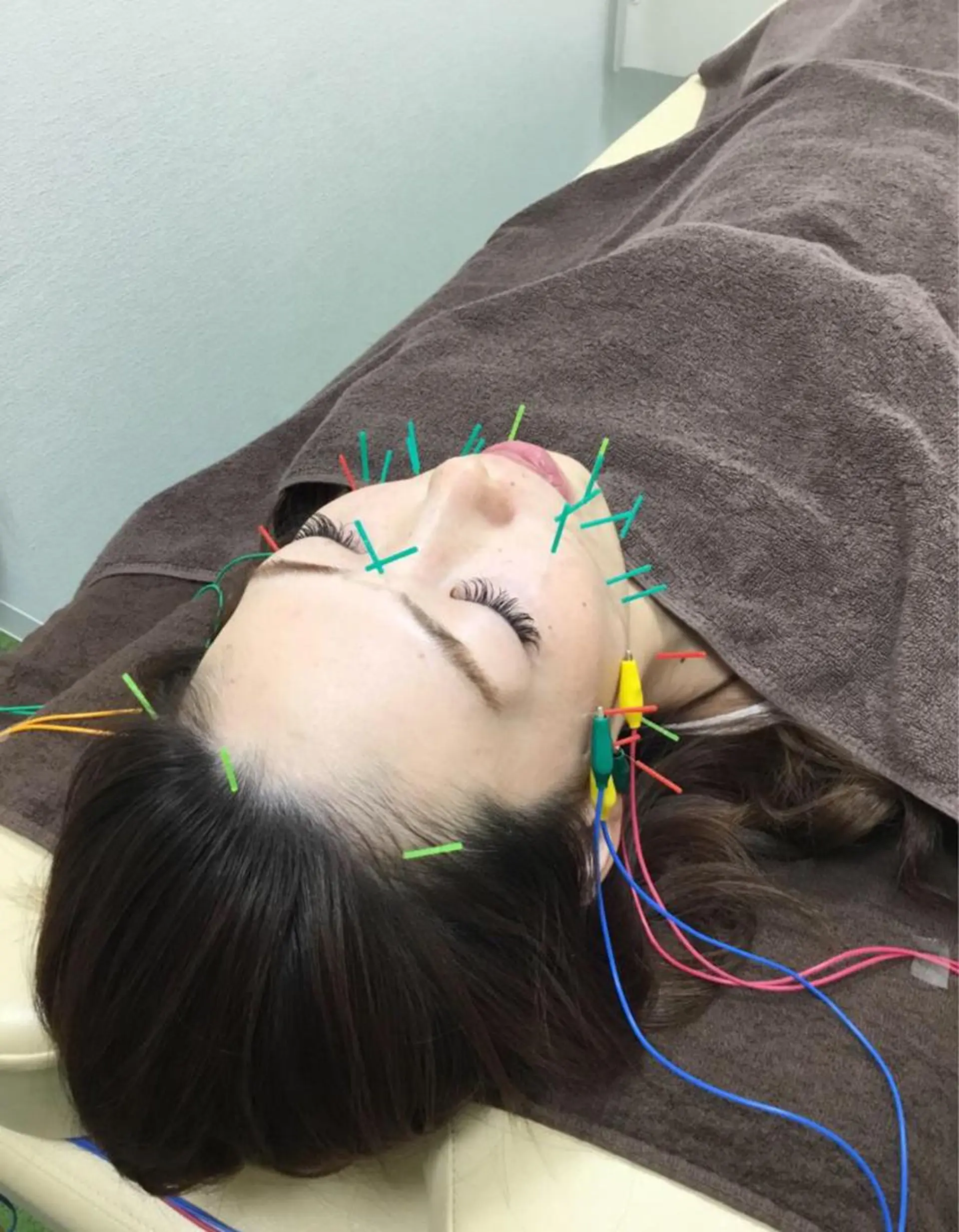 エステ リラク まごころ鍼灸整骨院所属・まごころ鍼灸整骨院 京王堀之内院のエステ・リラクイメージ