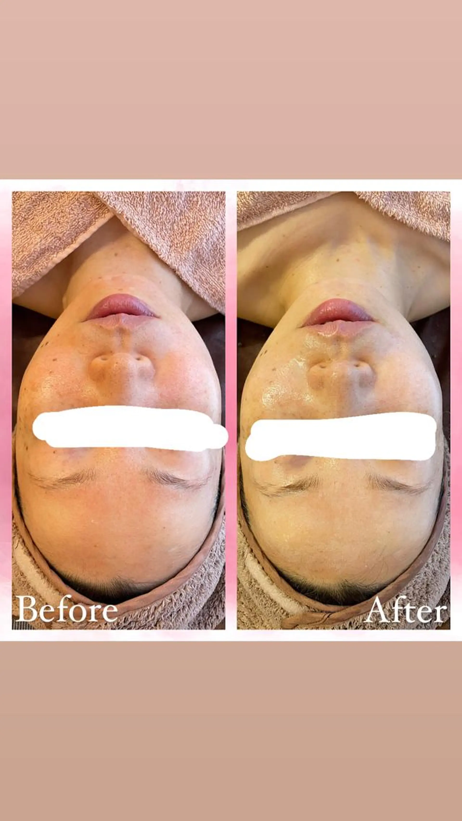 エステ salon〜RePCa〜(サロンルピカ)所属・山﨑 藍のエステ・リラクイメージ