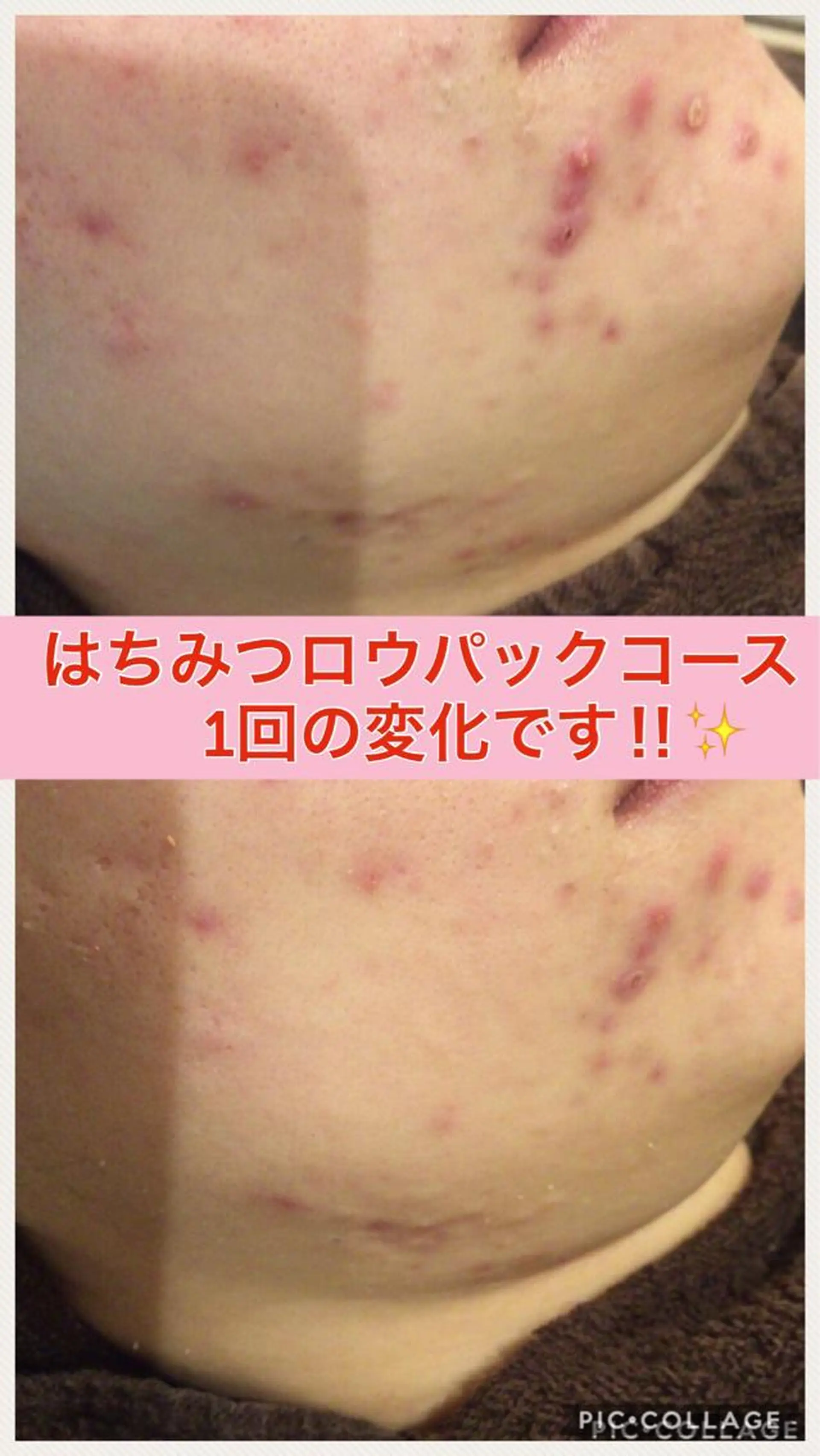 ミディアム カラー パーマ ヘアアレンジ メンズ キッズ ネイル マツエク・マツパ ニキビ・肌質改善専門 ♡人生が変わるサロンのエステ・リラクイメージ