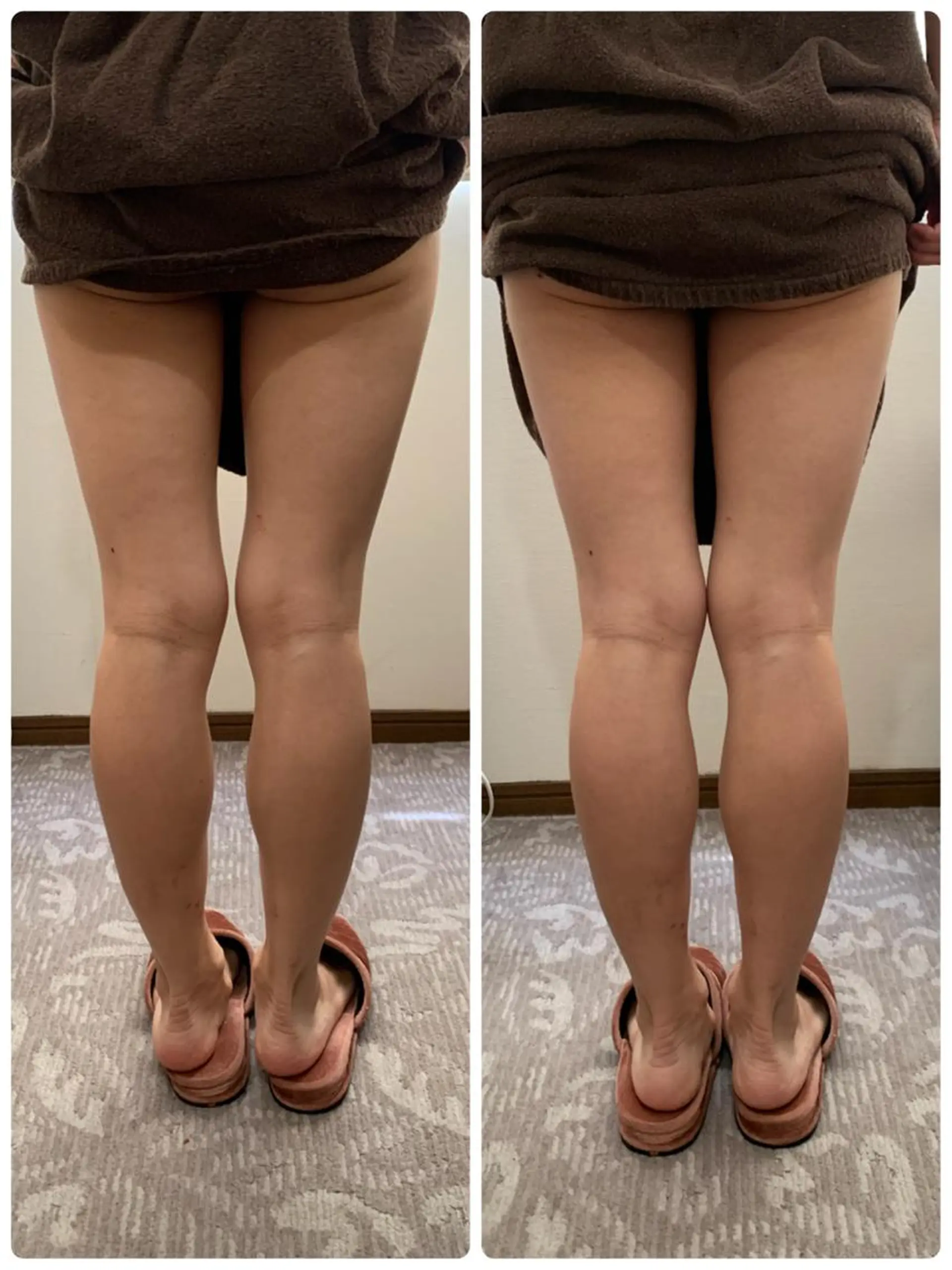 エステ espoir エスポワールのネイルデザイン