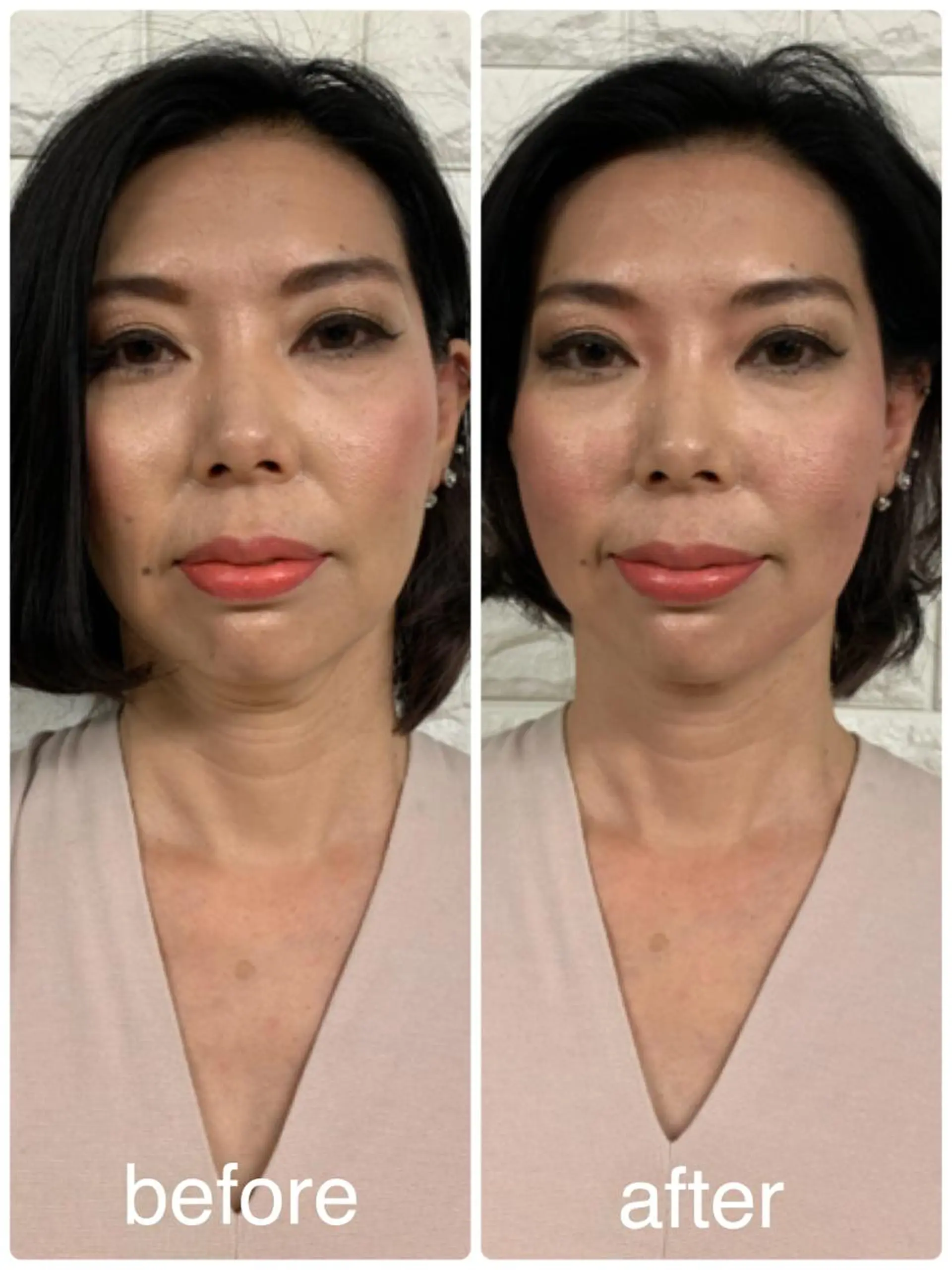 美容鍼 IKEZAKIのエステ・リラクイメージ