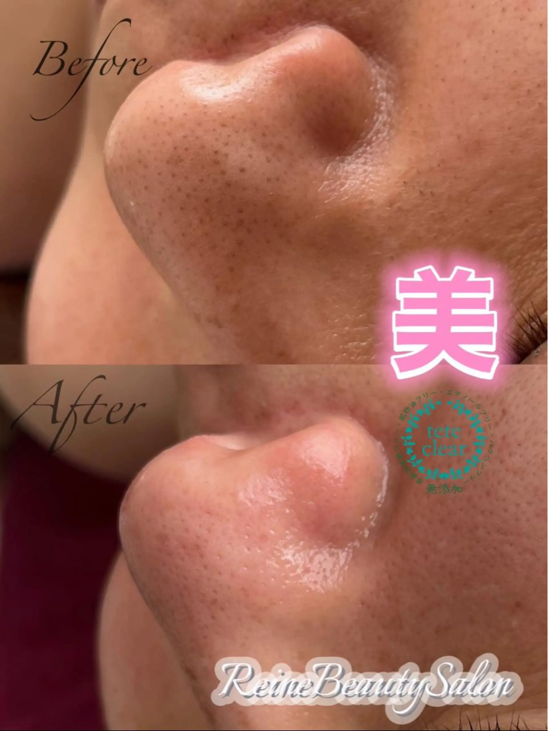 Reine BeautySalon所属・毛穴/シミ肝斑/脱毛 横山梨里のエステ・リラクイメージ