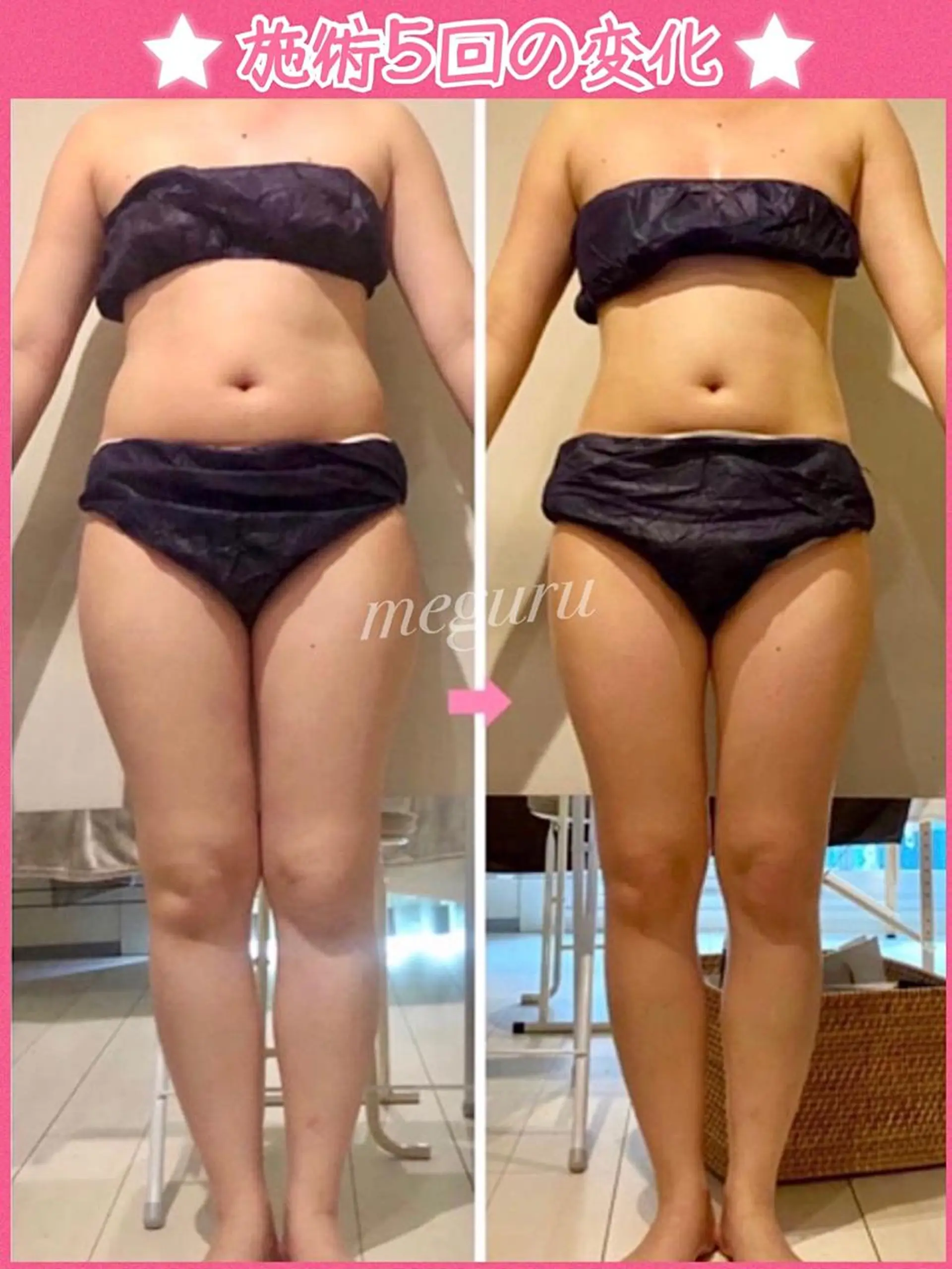 ショート カラー パーマ ヘアアレンジ メンズ キッズ ネイル マツエク・マツパ ‍痩身＆ボディ 結果出し🌟丹野のエステ・リラクイメージ