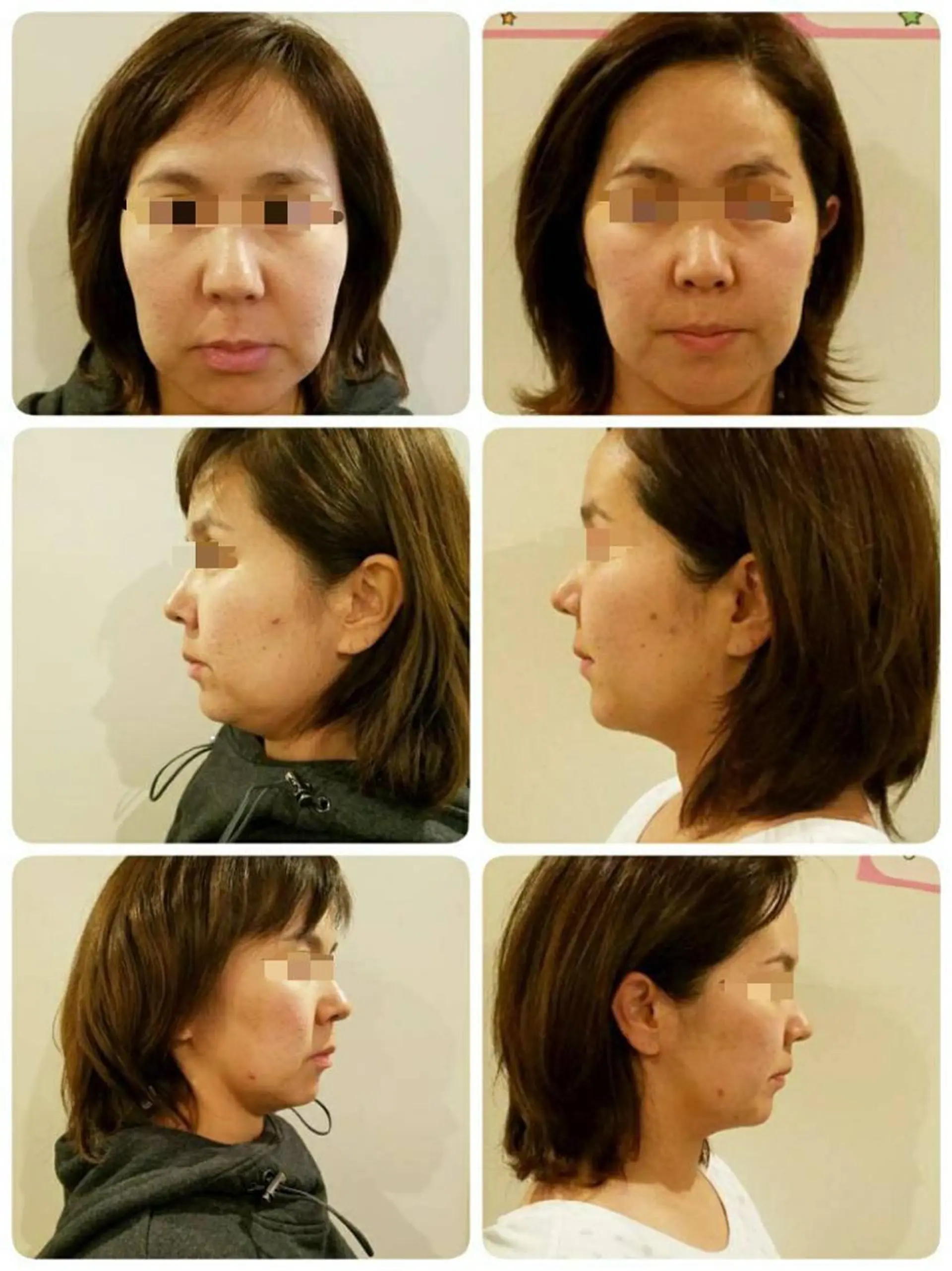 HappIness 遠赤外線ドームのエステ・リラクイメージ