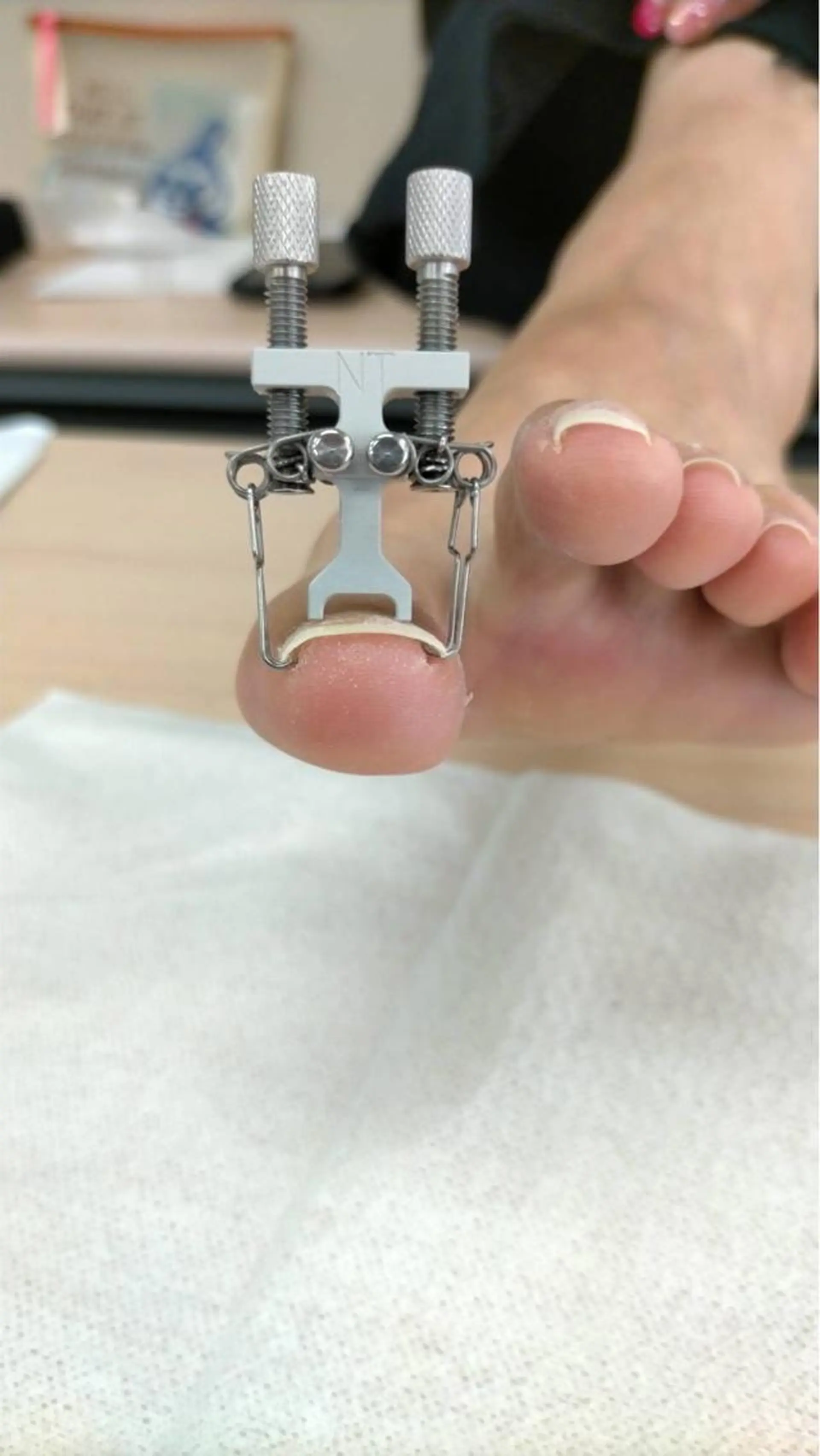 ネイル フットネイル 深爪を断らない スカルプ高評価店のネイルデザイン