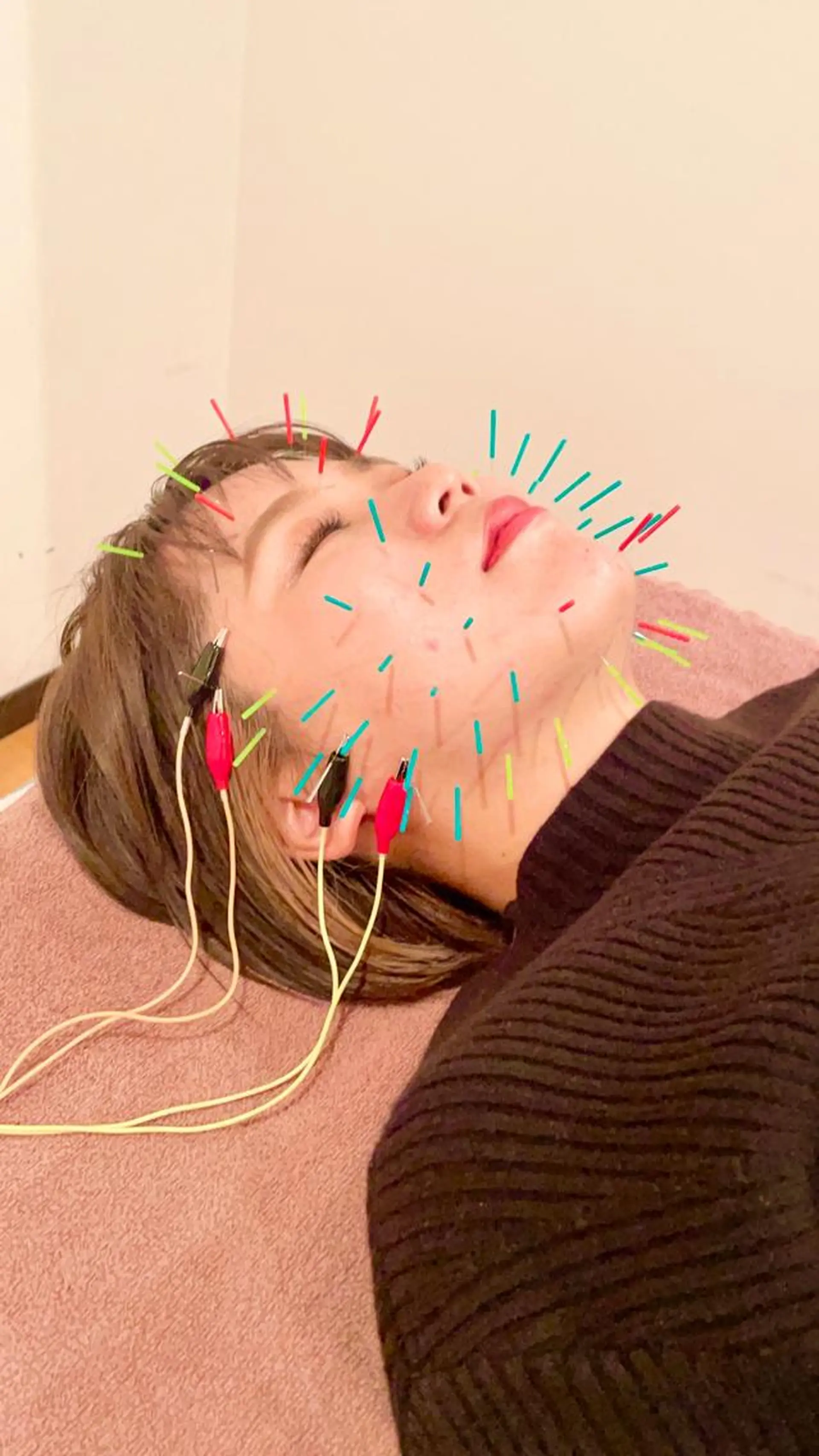 その他 美容鍼灸サロン　TIARA所属・鍼灸サロン TIARA　美容鍼のエステ・リラクイメージ