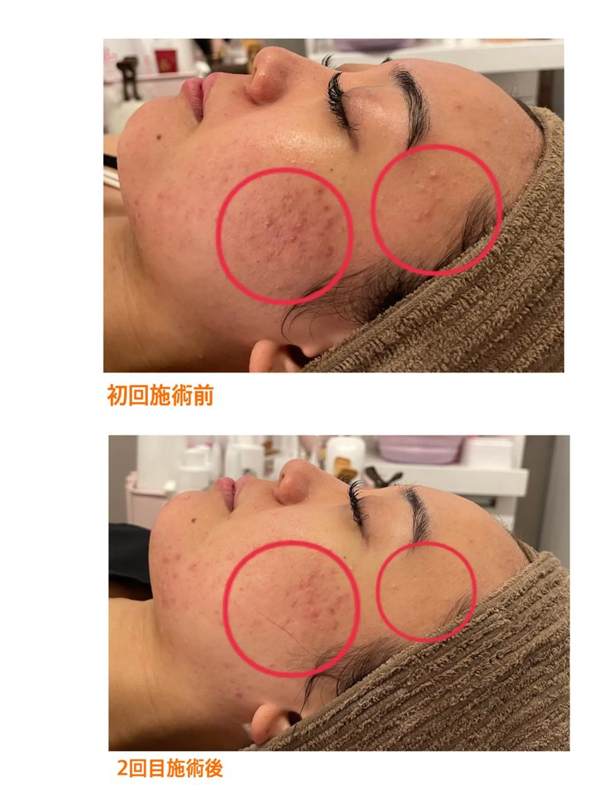 メンズ エステ 肌改善/まつげパーマ 🌙Luunaのエステ・リラクイメージ