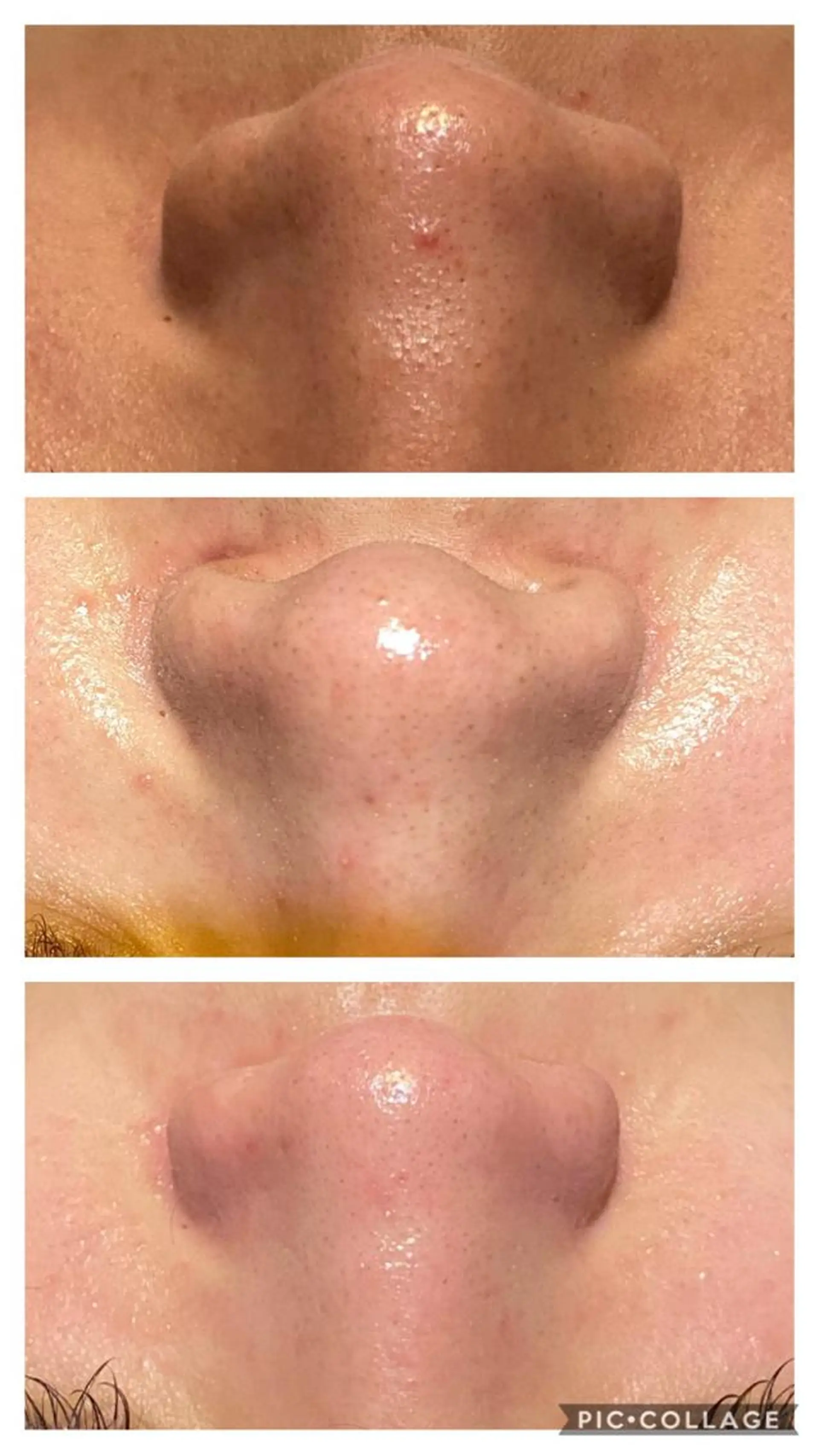 natura chuchuナトゥーラチュチュ所属・バスト体験 ナトゥーラチュチュのエステ・リラクイメージ