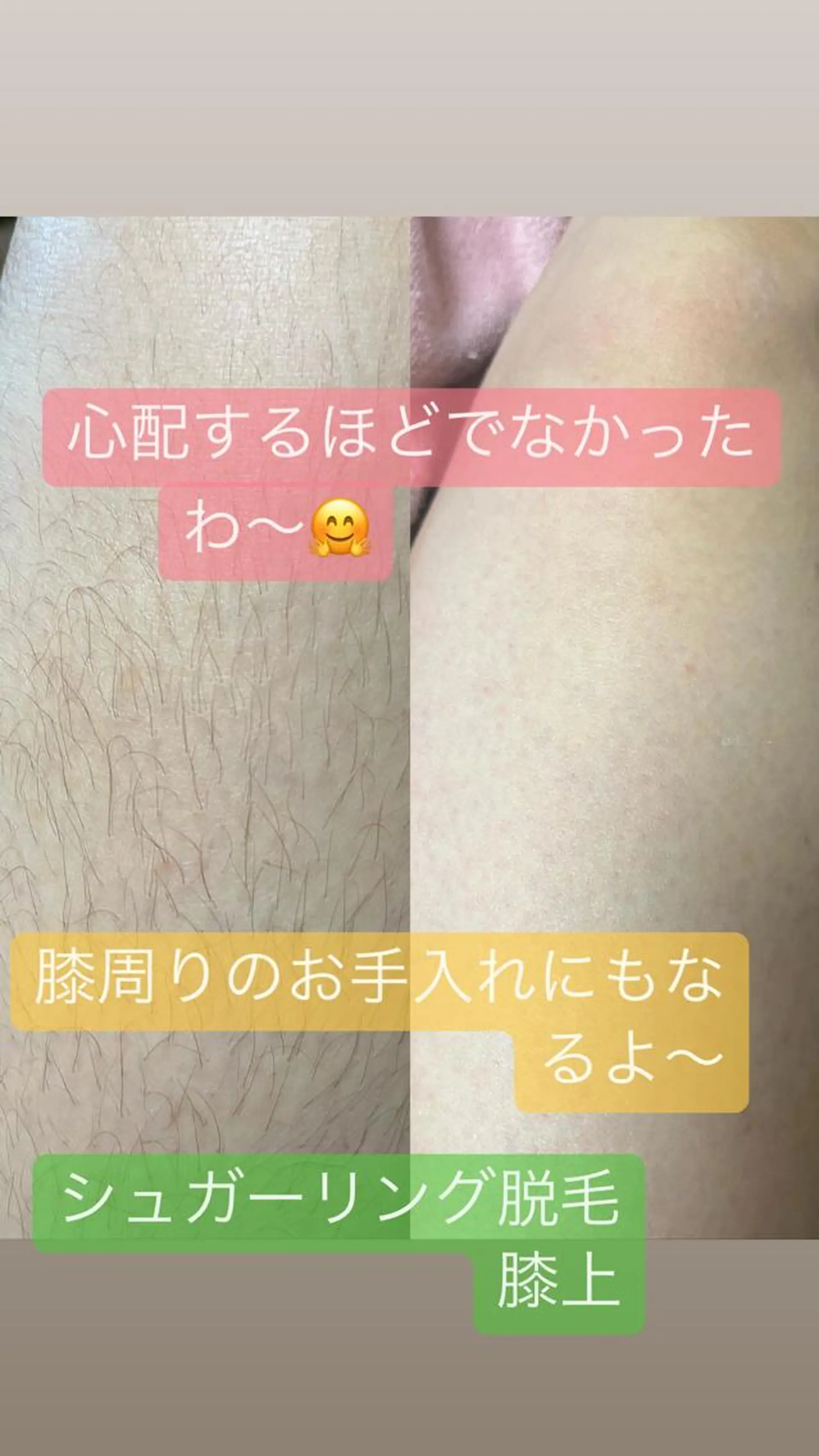 脱毛 うえつま ふみえのエステ・リラクイメージ