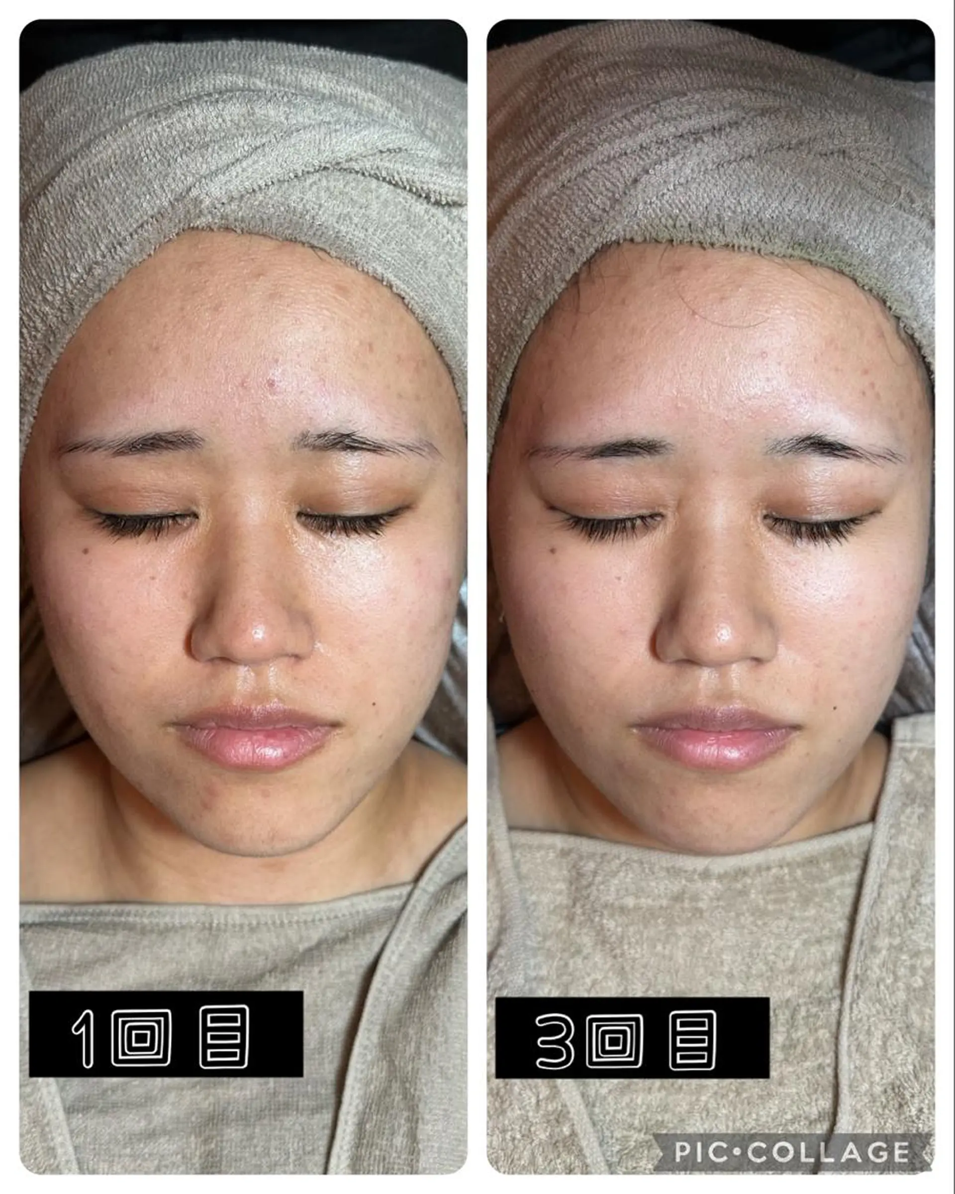 エステ Feel♡ JYURIAのネイルデザイン