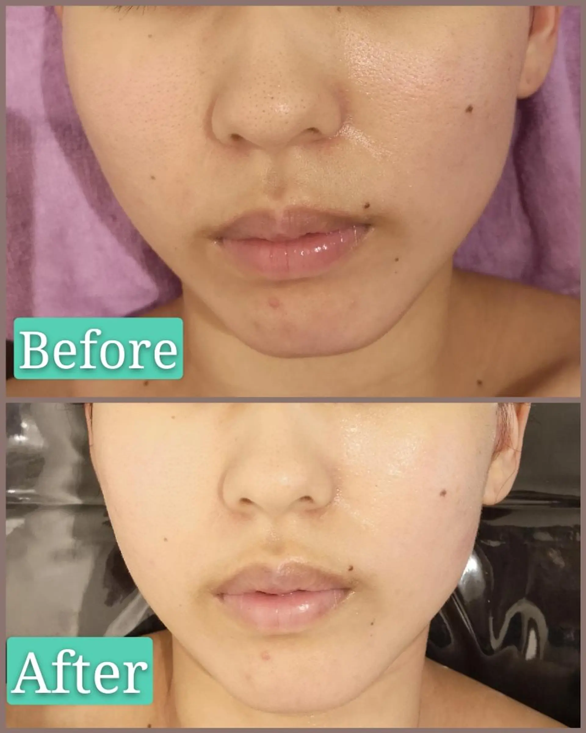 エステ 🅖🅤🅩🅔🅛 salonのエステ・リラクイメージ