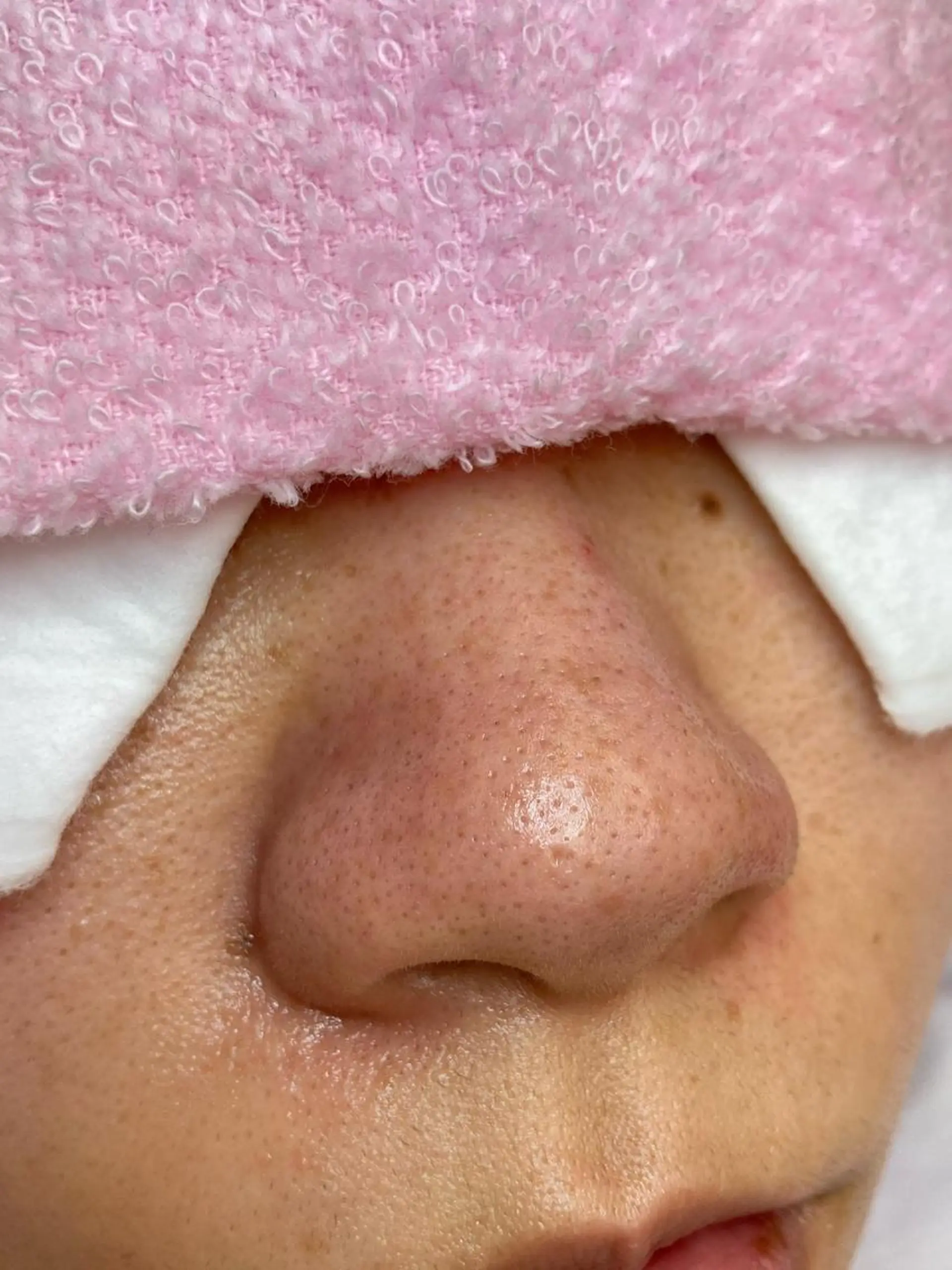 フェイシャルエステFOUATONS＊所属・ﾌｪｲｼｬﾙｴｽﾃ ふわっとんのエステ・リラクイメージ