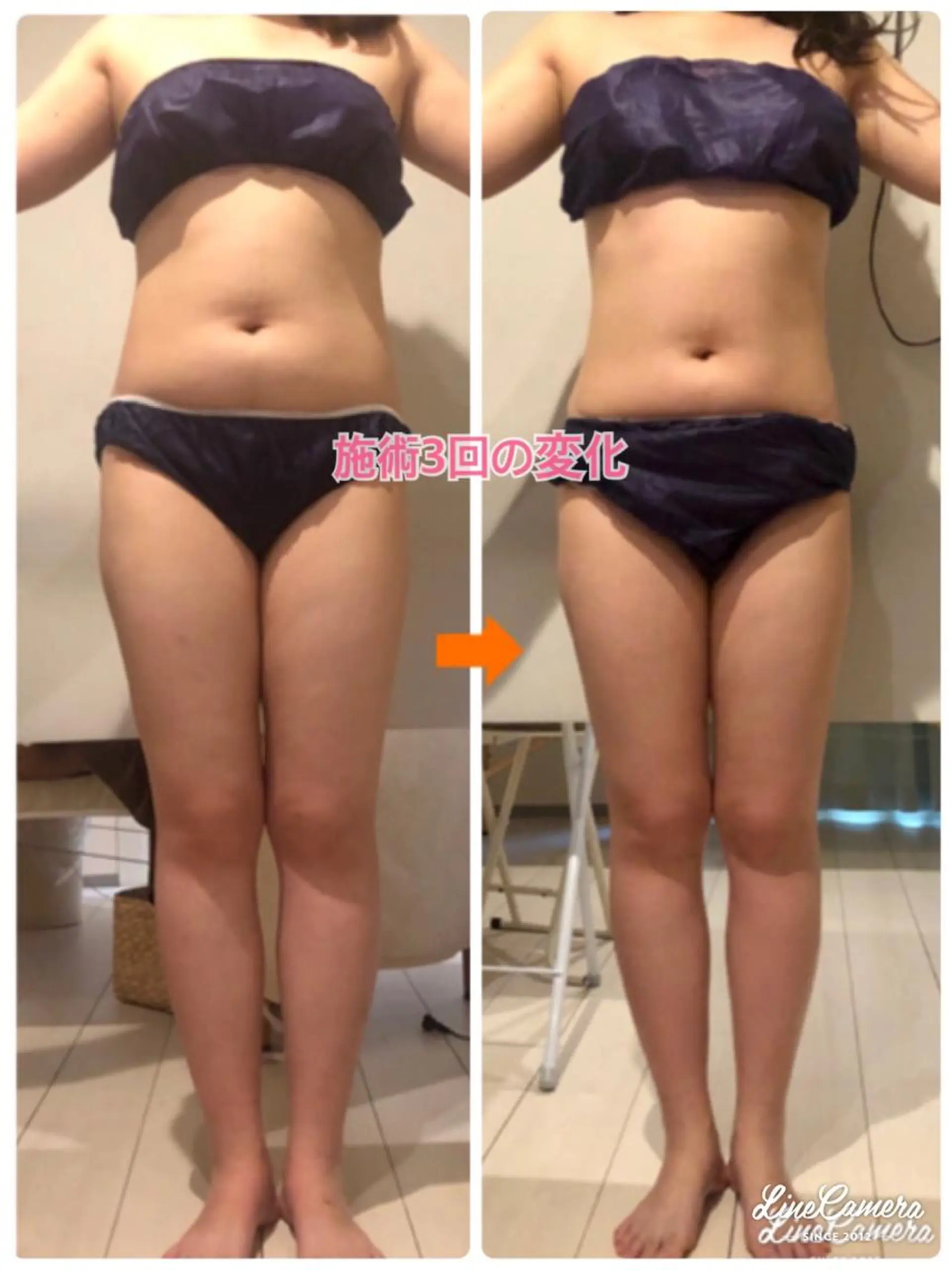 ショート カラー パーマ ヘアアレンジ メンズ キッズ ネイル マツエク・マツパ エステ リラク ‍痩身＆ボディ 結果出し🌟丹野のエステ・リラクイメージ