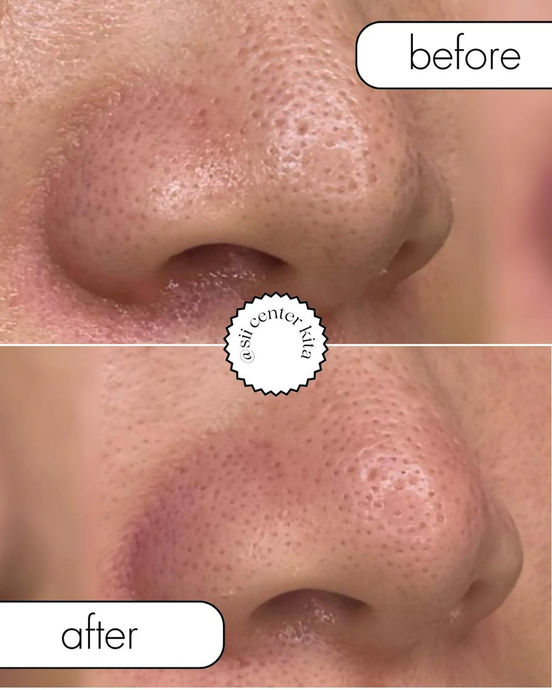 OAK×NACHUL 成城学園前のエステ・リラクイメージ