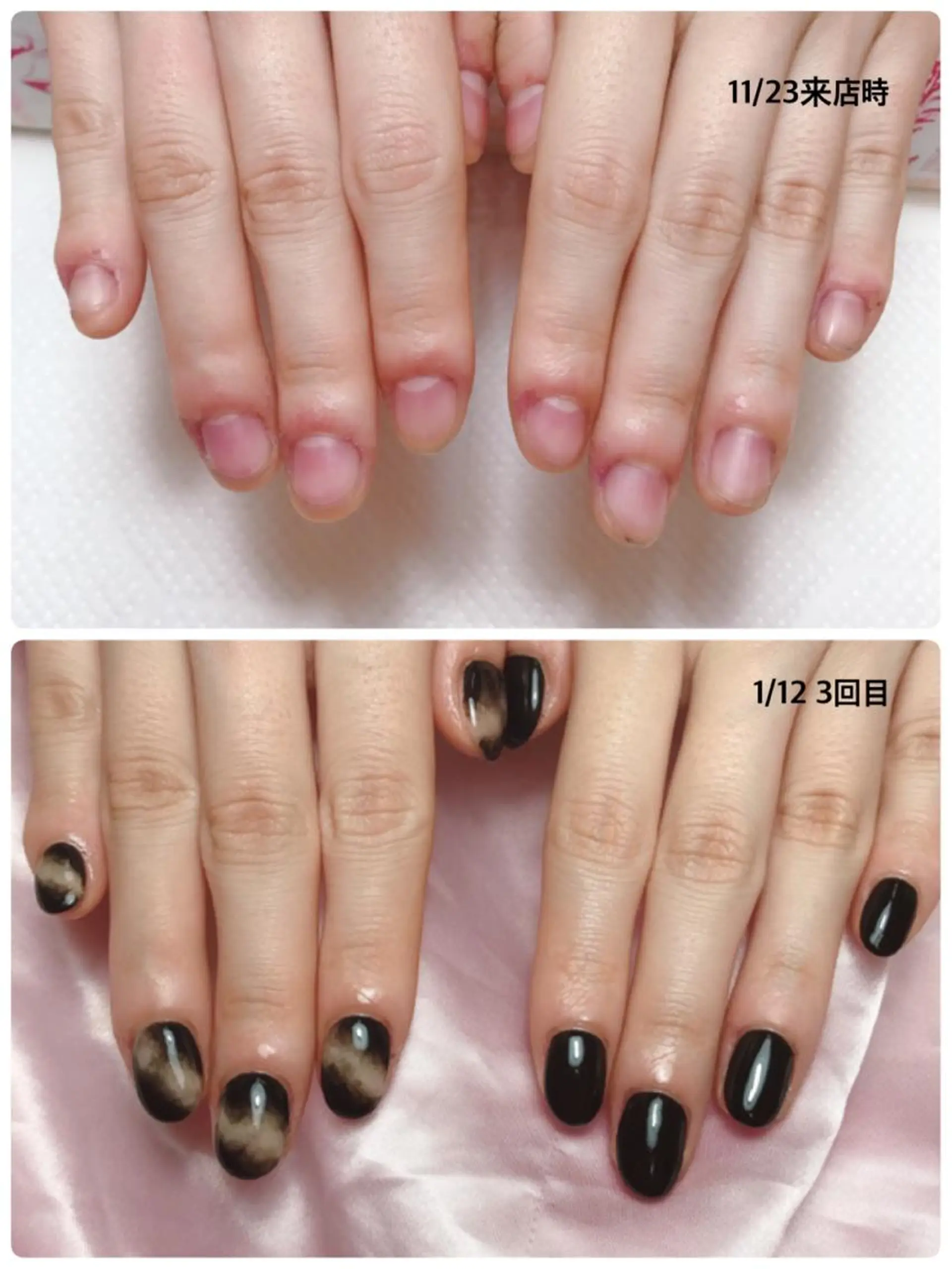 ネイル ハンドネイル 深爪を断らない スカルプ高評価店のネイルデザイン