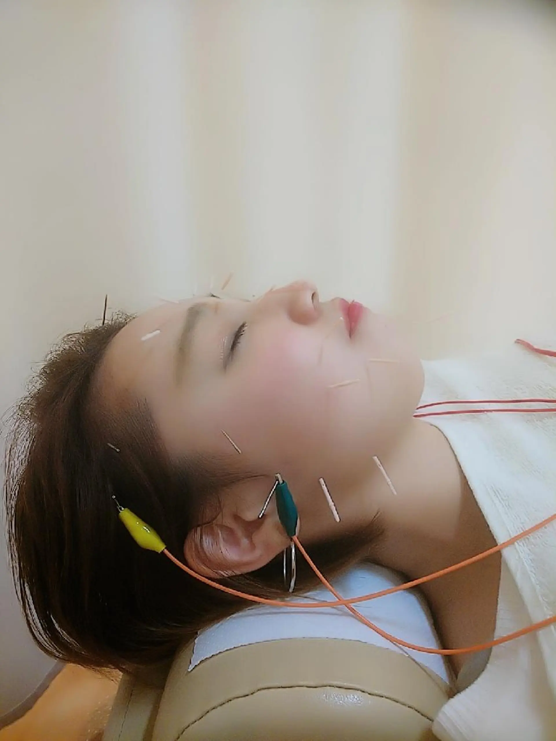 お顔のむくみたるみ 専門☆美容鍼小顔矯正のエステ・リラクイメージ