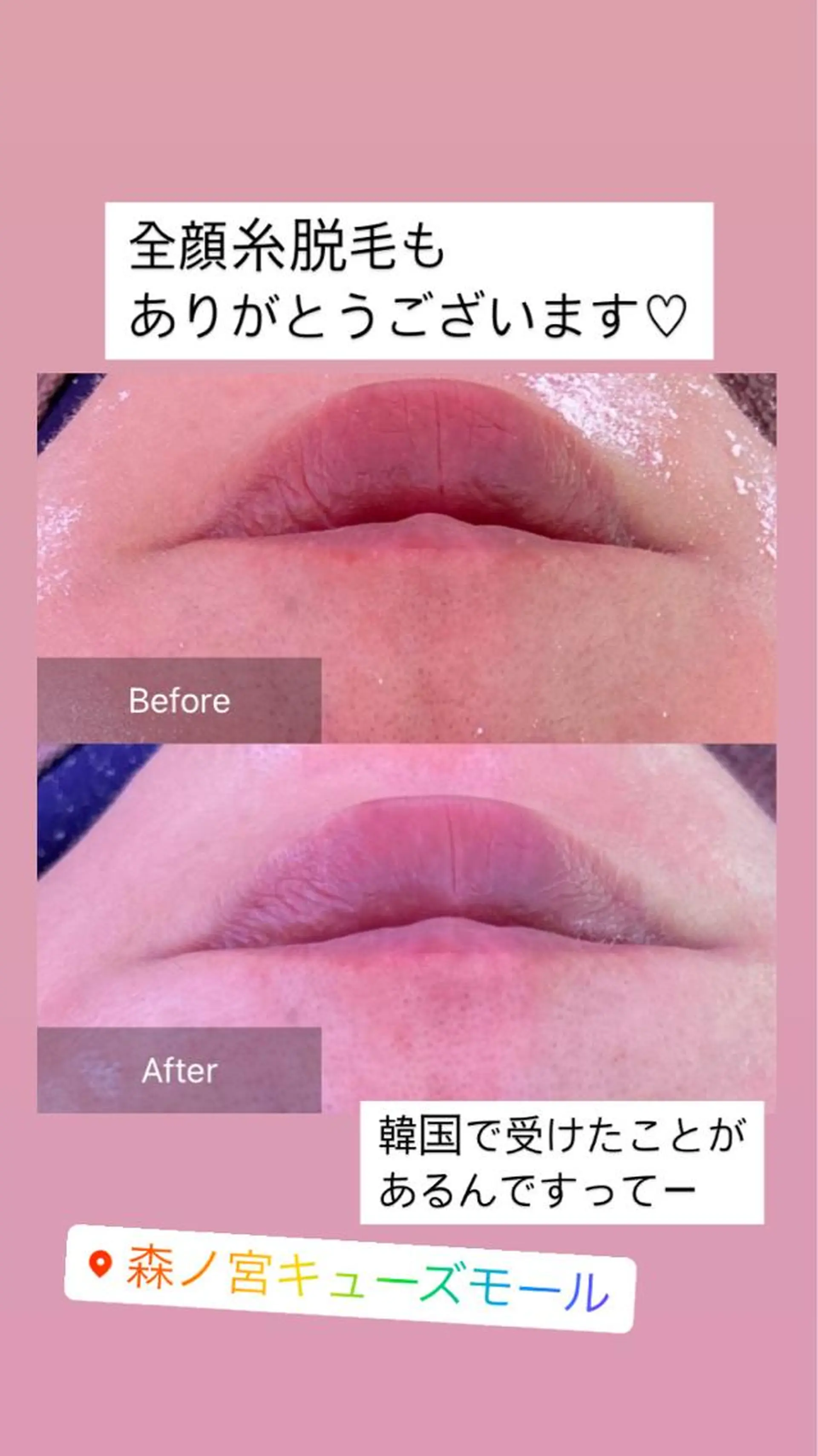 エステ 産毛専門店 Bittoのエステ・リラクイメージ