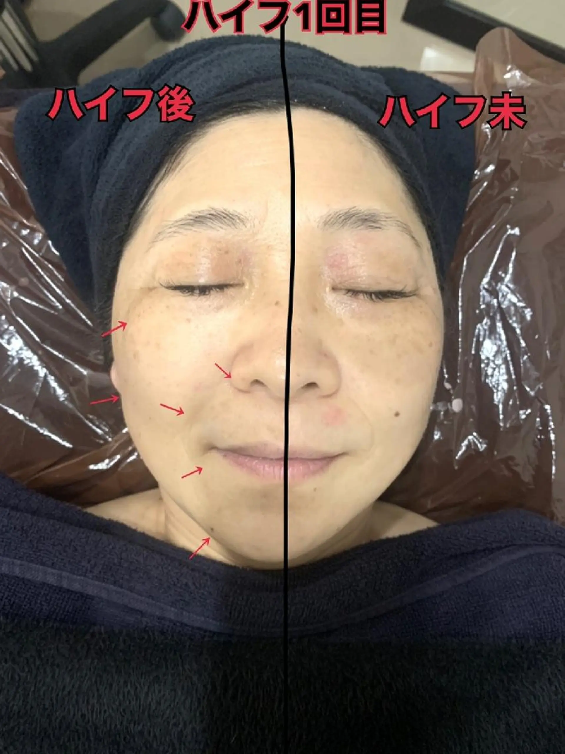 SESUNNY セサニー SEIRAのマツエク・マツパデザイン