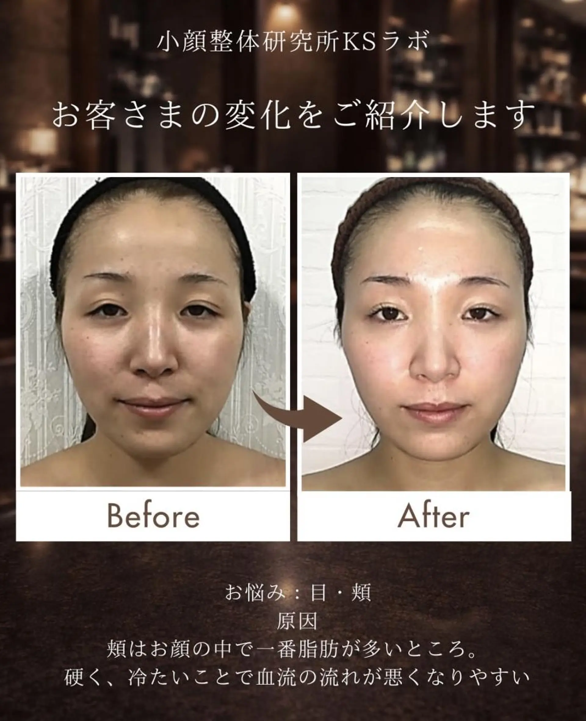 小顔整体研究所 KSラボ川崎店内田のエステ・リラクイメージ