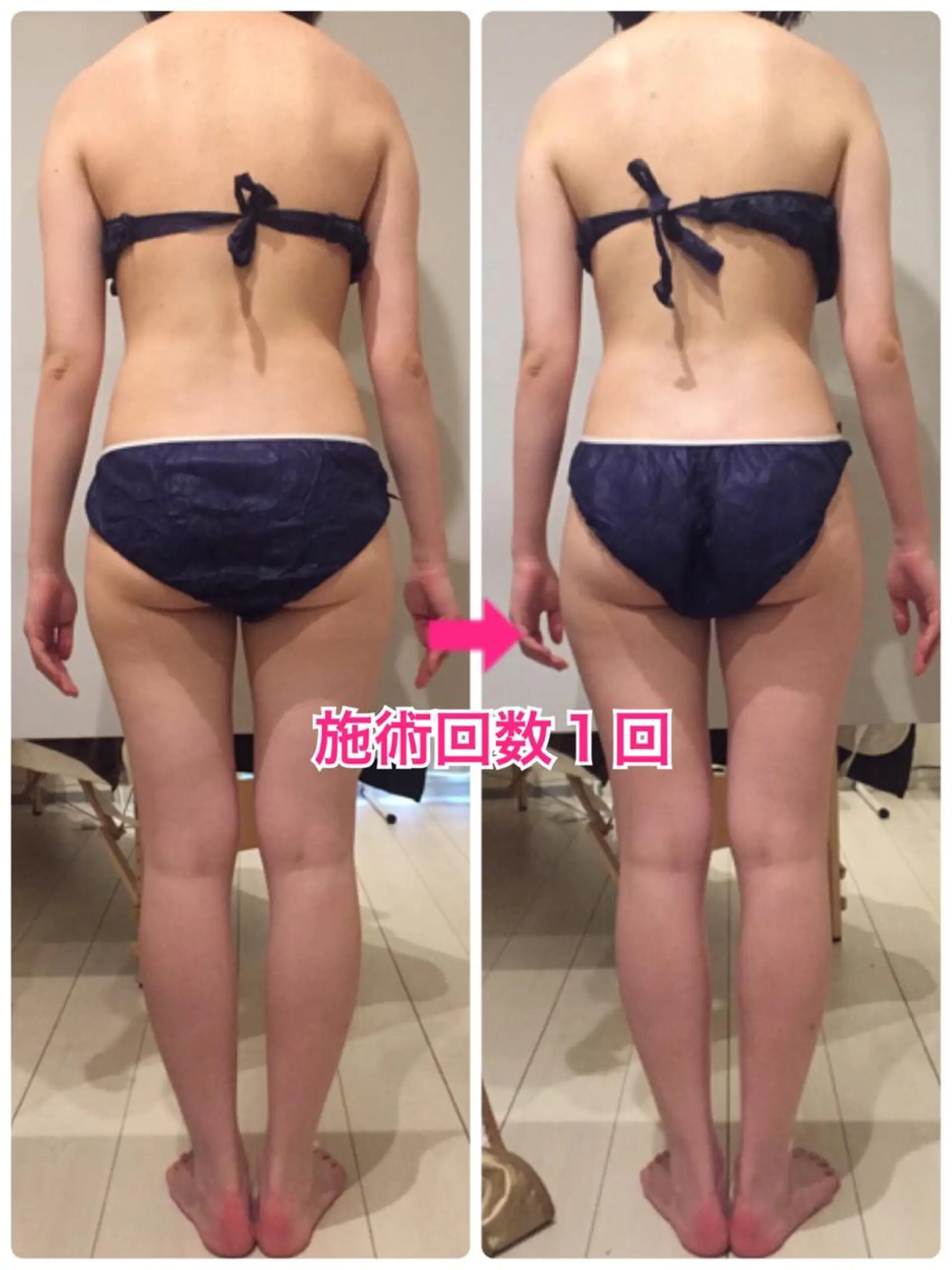 ミディアム カラー パーマ ヘアアレンジ メンズ キッズ ネイル マツエク・マツパ ‍痩身＆ボディ 結果出し🌟丹野のエステ・リラクイメージ