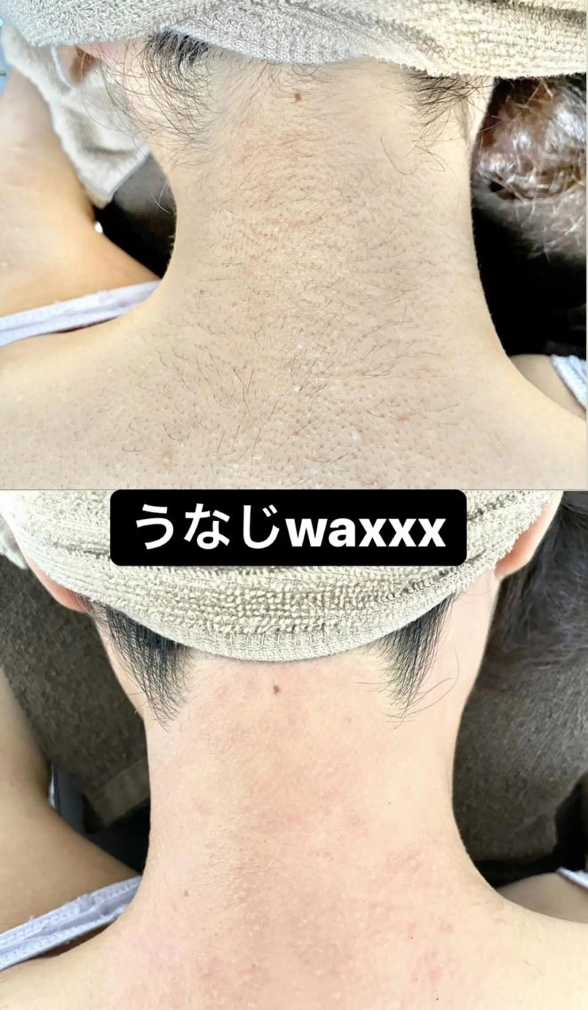 メンズ 脱毛 Epina 千葉店 【エピナ】のエステ・リラクイメージ