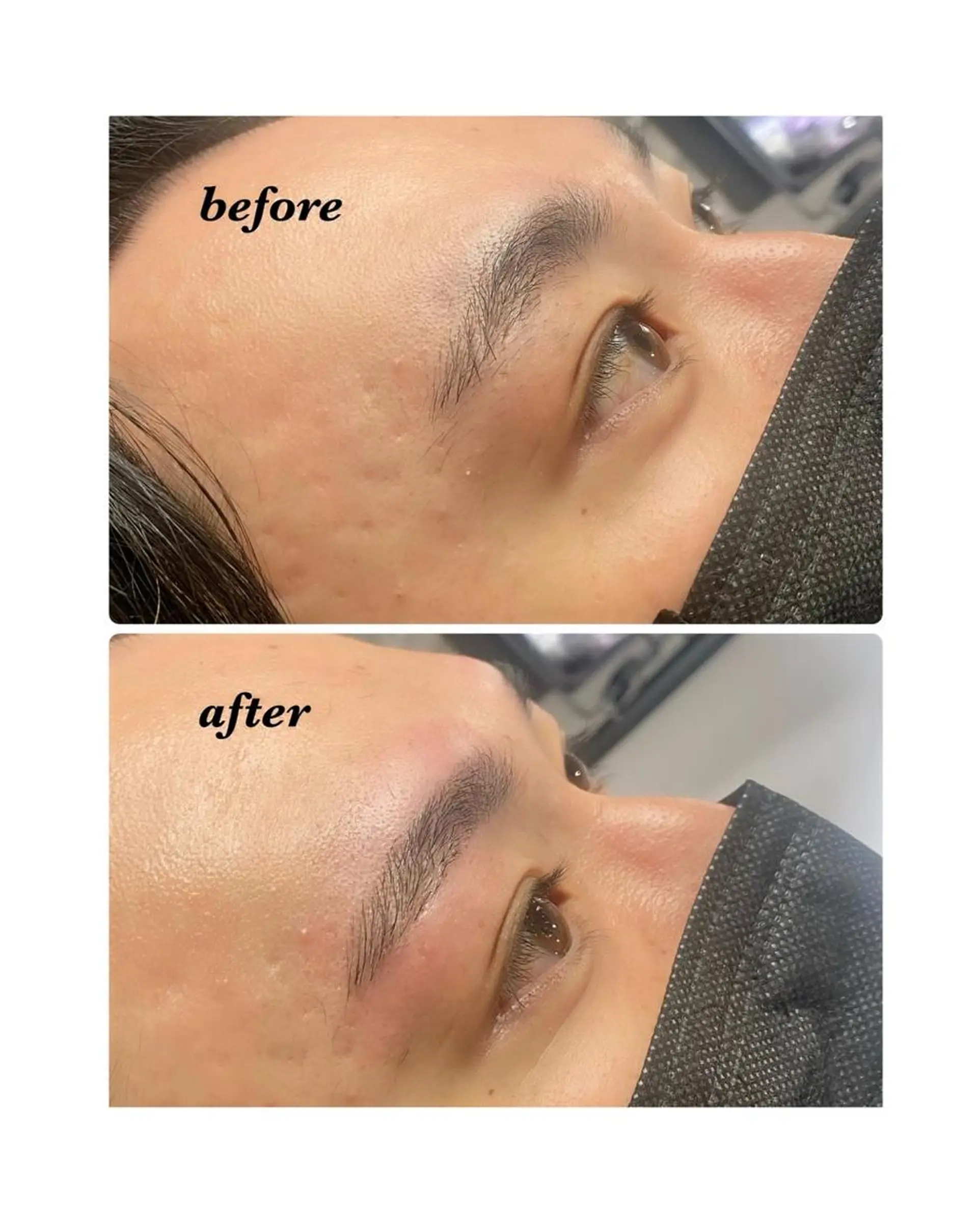 アイブロウ ハーブピーリング/韓国肌管理/フェイシャル/毛穴洗浄/眉毛/顔脱毛【糸脱毛専門】rev所属・ハーブピーリング🌹 毛穴洗浄❤️眉waxのエステ・リラクイメージ