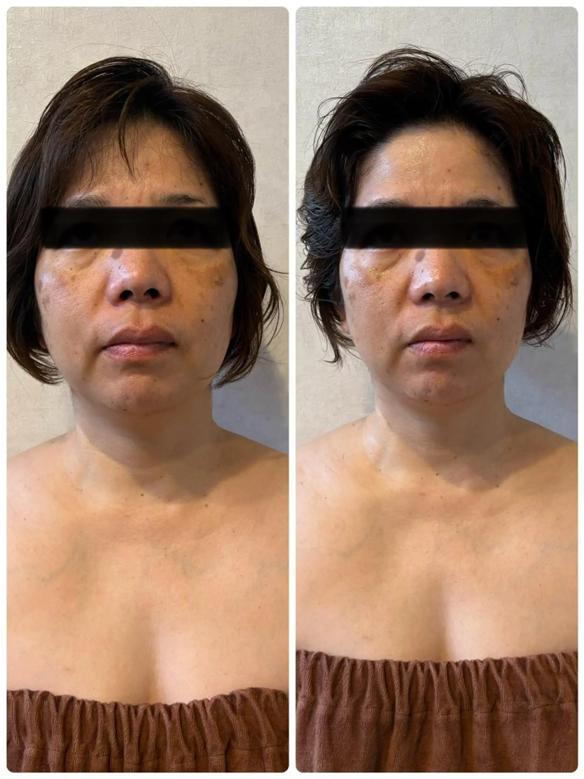 BLESS BEAUTYのエステ・リラクイメージ