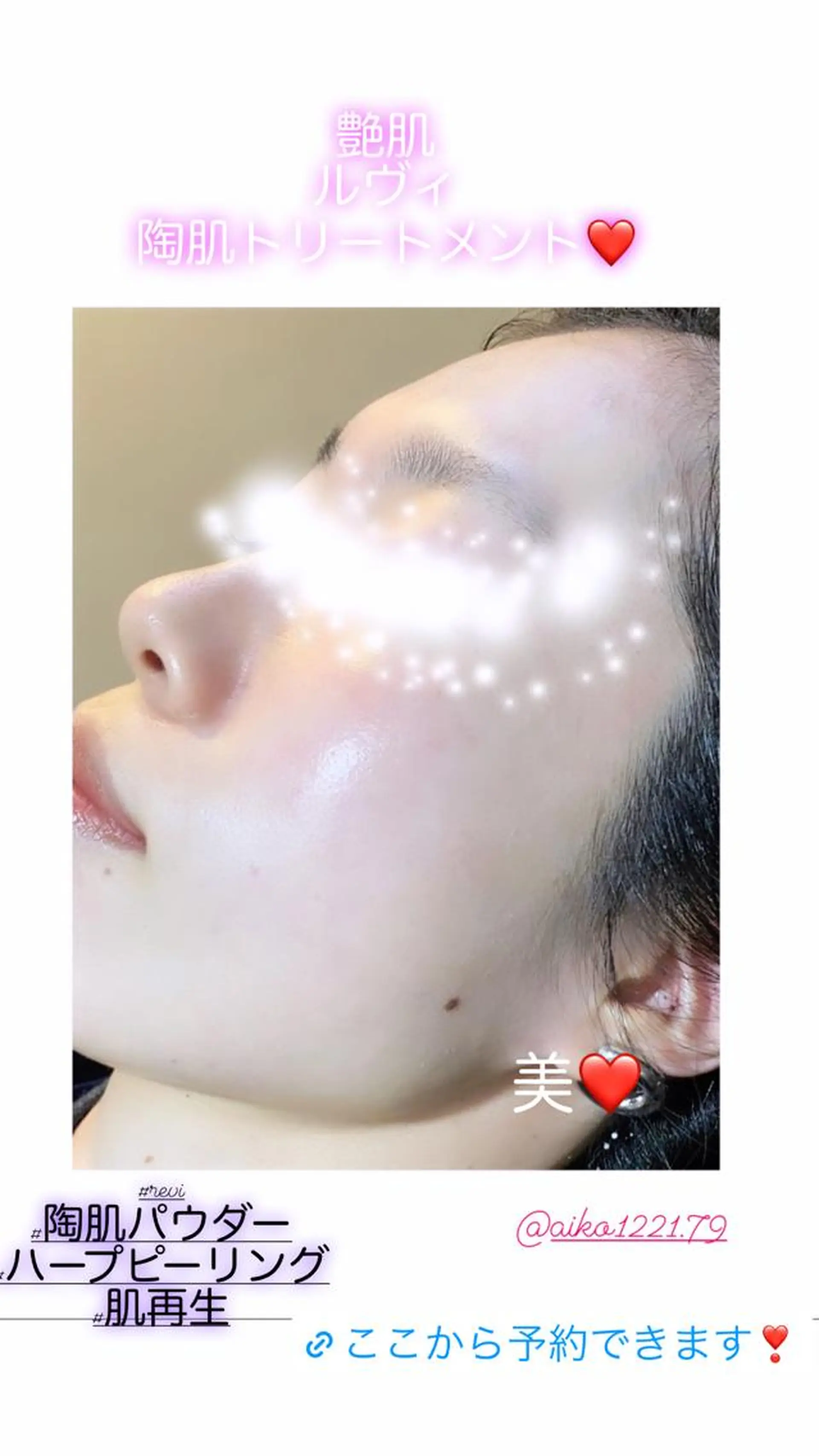 ハーブピーリング/韓国肌管理/フェイシャル/毛穴洗浄/眉毛/顔脱毛【糸脱毛専門】rev所属・ハーブピーリング🌹 毛穴洗浄❤️眉waxのエステ・リラクイメージ