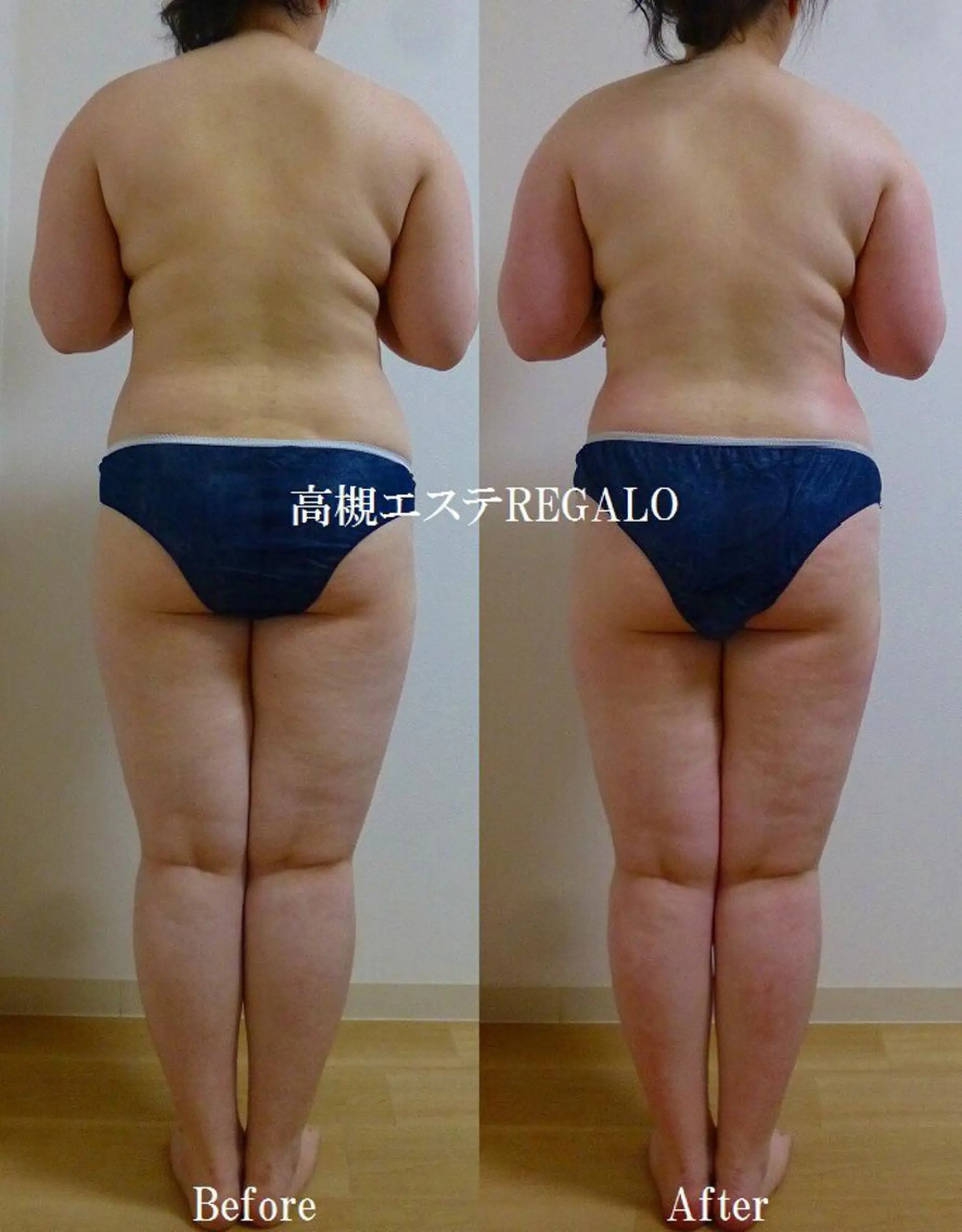 エステ REGALO所属・矢野 さやかのエステ・リラクイメージ