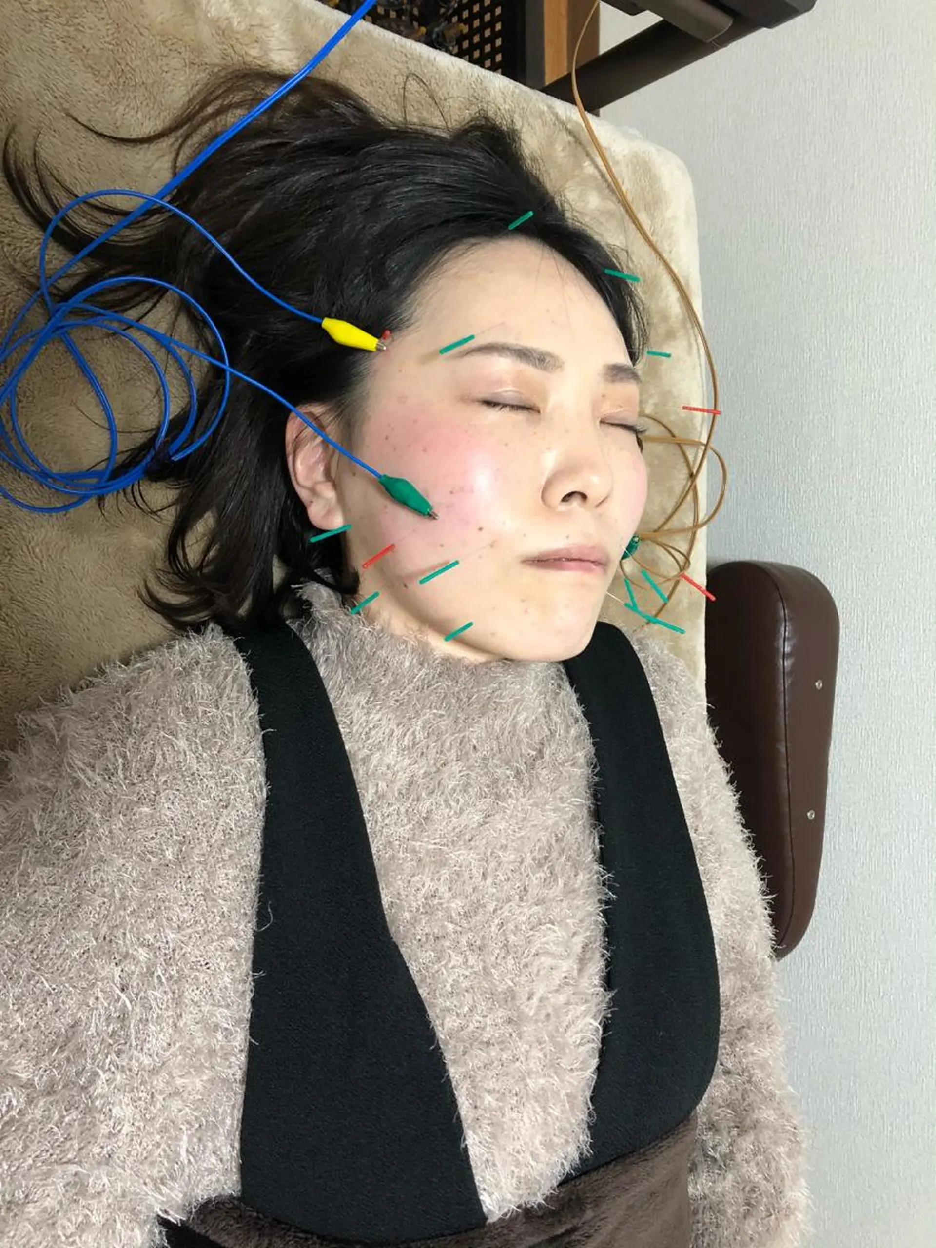 エステ リラク やはた鍼灸整骨院所属・やはた 鍼灸整骨院のエステ・リラクイメージ