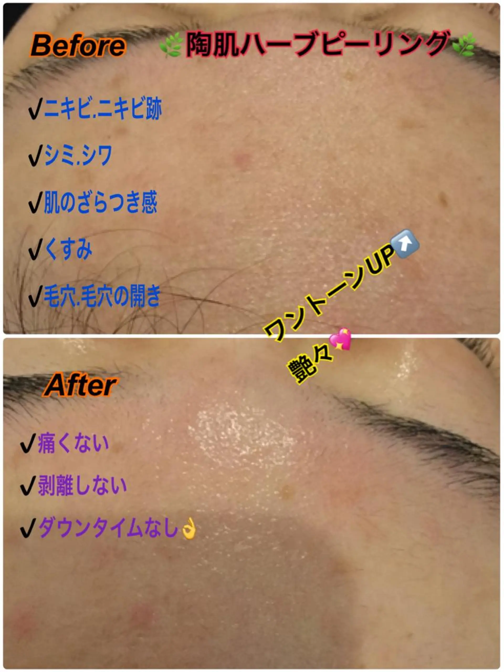 エステ 【リベルハーブピーリング認定店】敏感肌・美白脱毛専門店Dione立川店所属・Dione 立川店のエステ・リラクイメージ