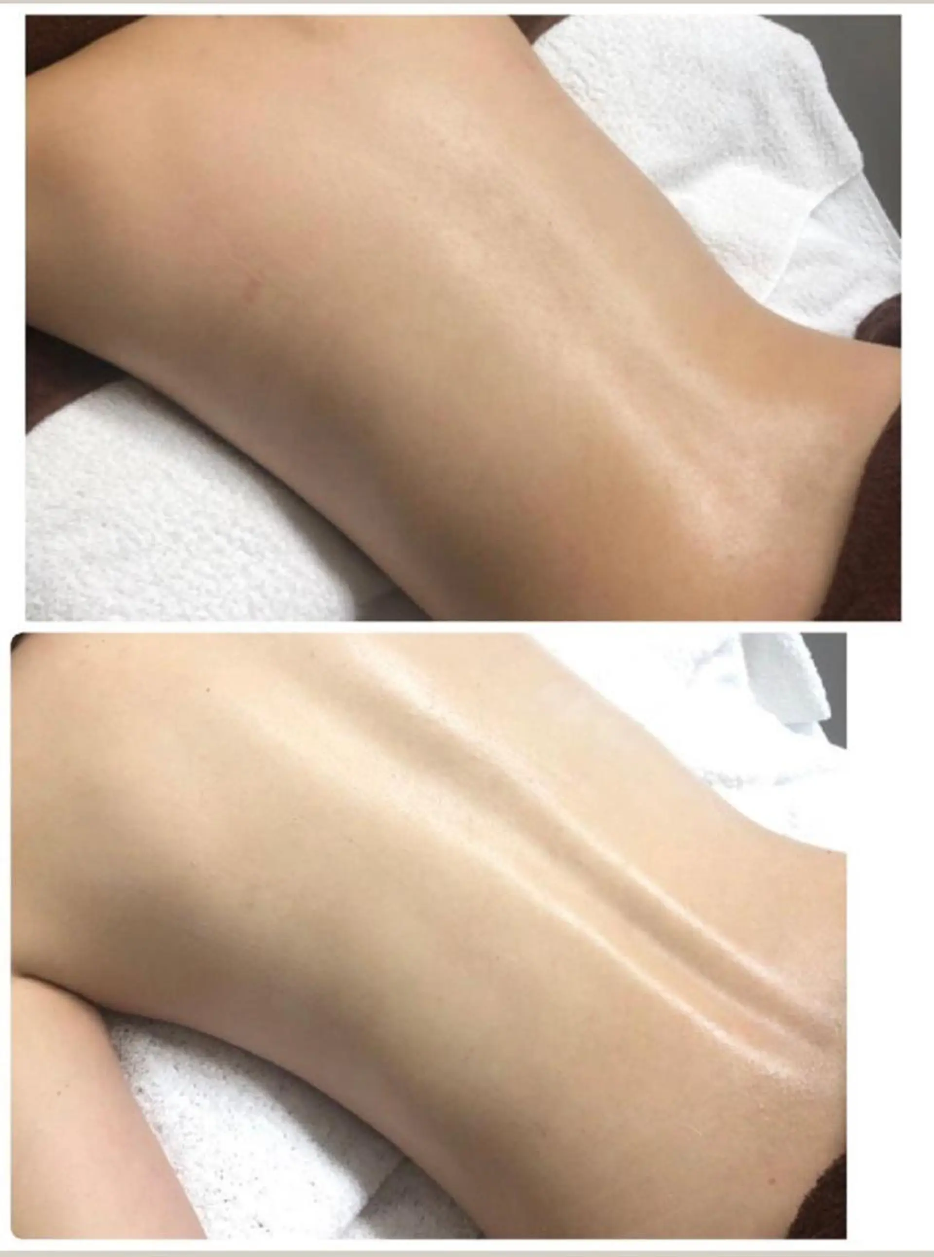 エステ リラク M渋谷店所属・Ｍ渋谷 ホワイトニングのエステ・リラクイメージ