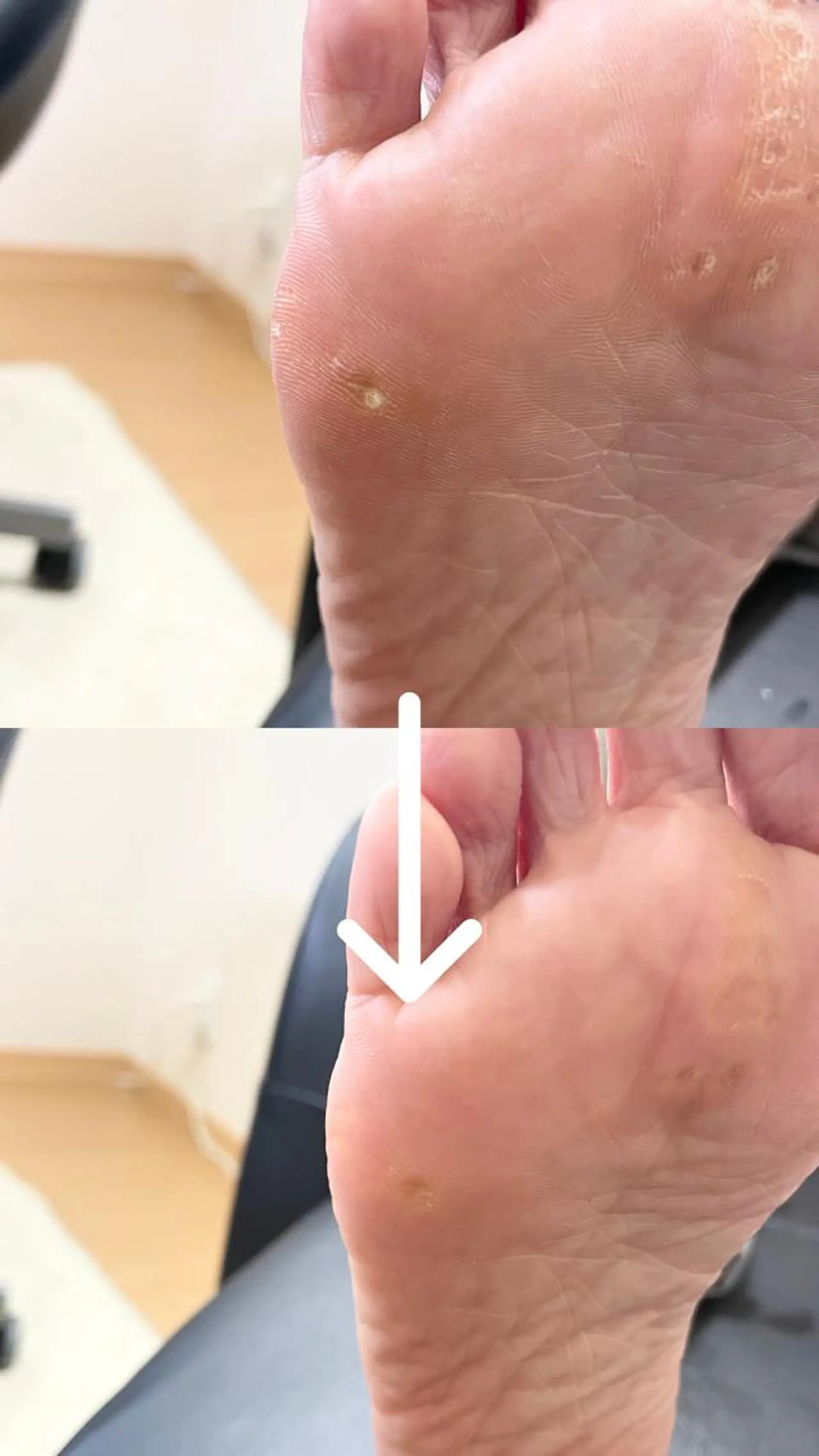 深爪・巻き爪 専門サンセリテのネイルデザイン