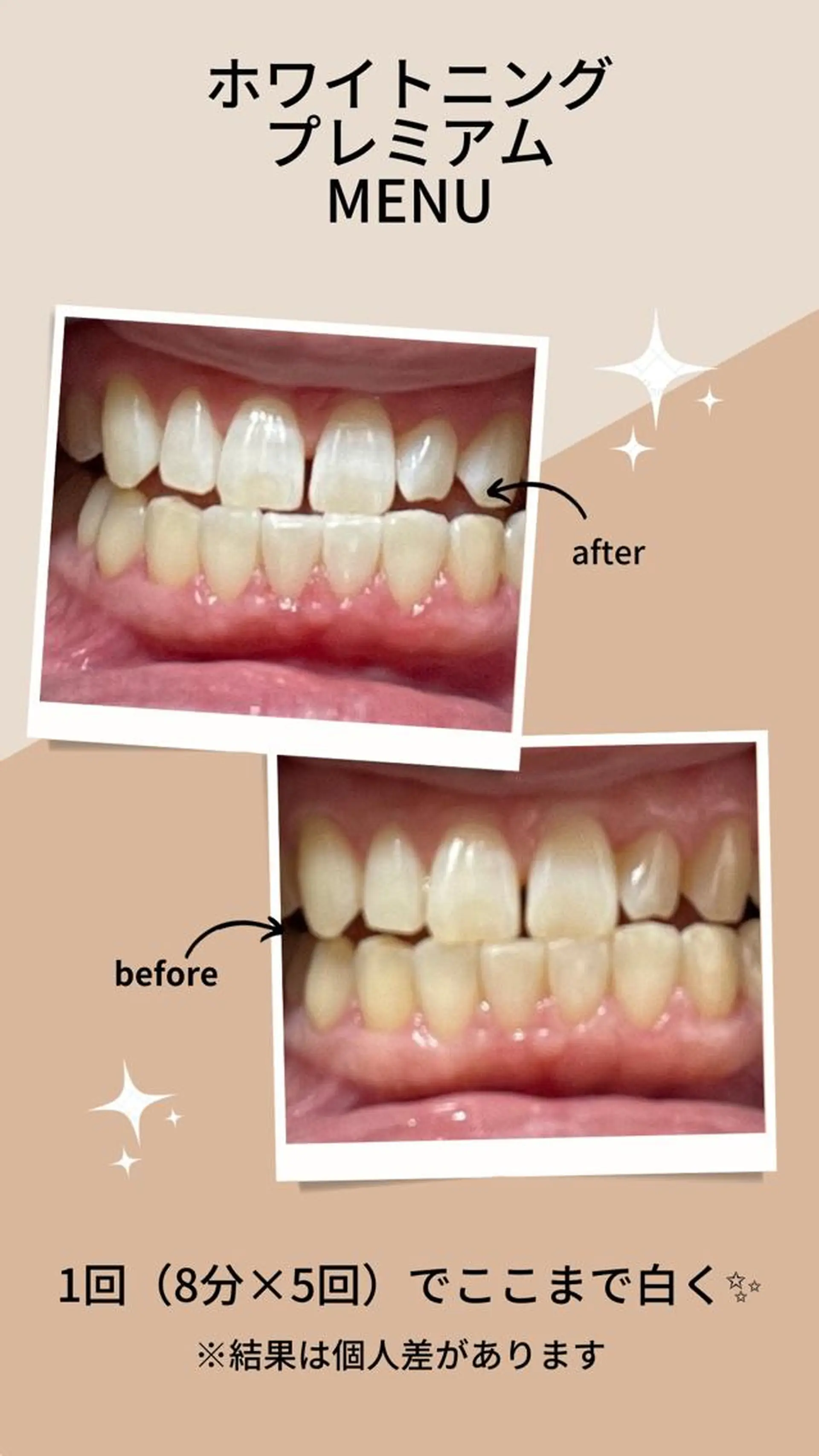 Embellir ♡鏡味のその他イメージ