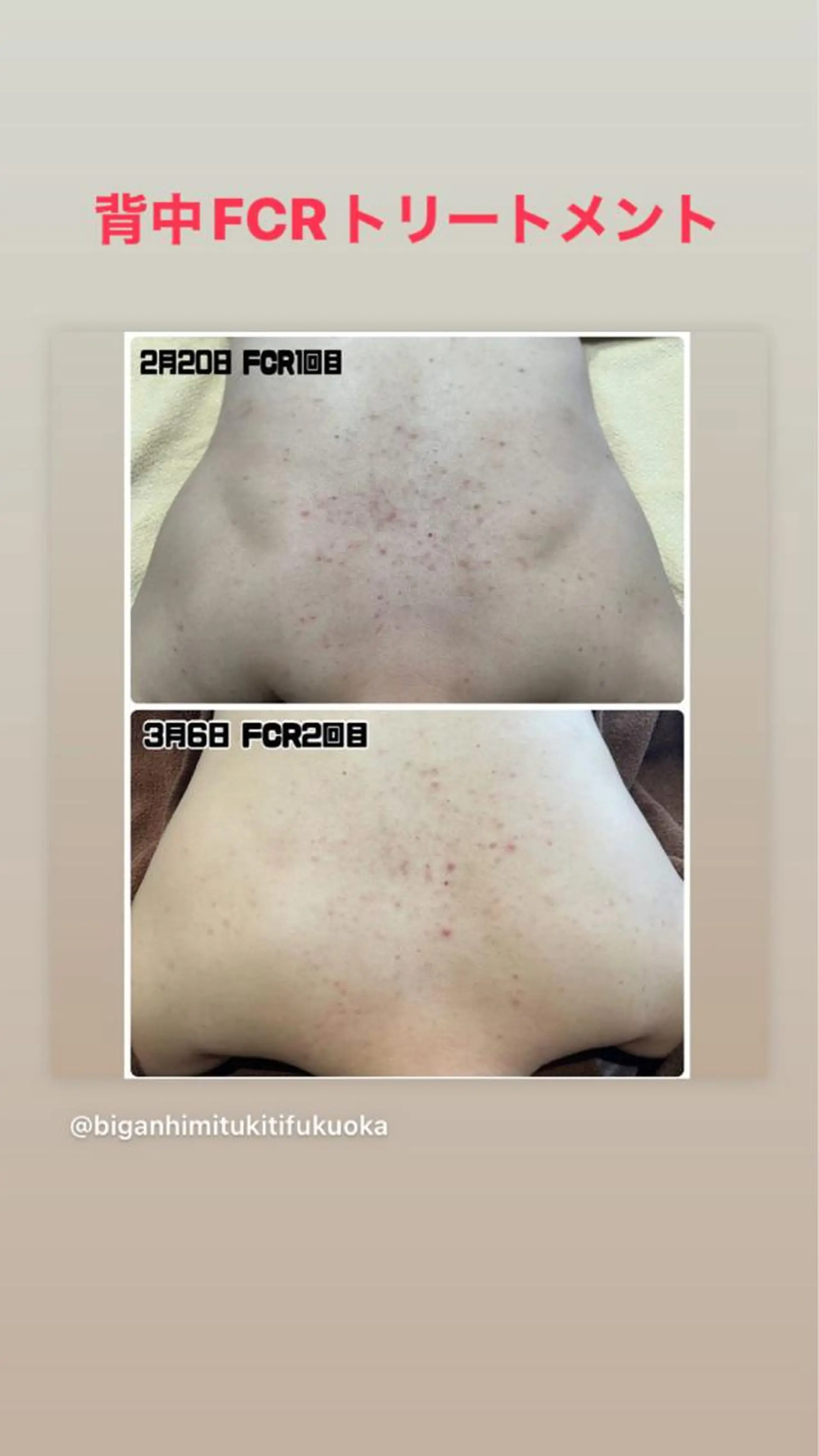 エステ 美顔秘密基地新宮所属・美顔秘密基地 新宮のその他イメージ