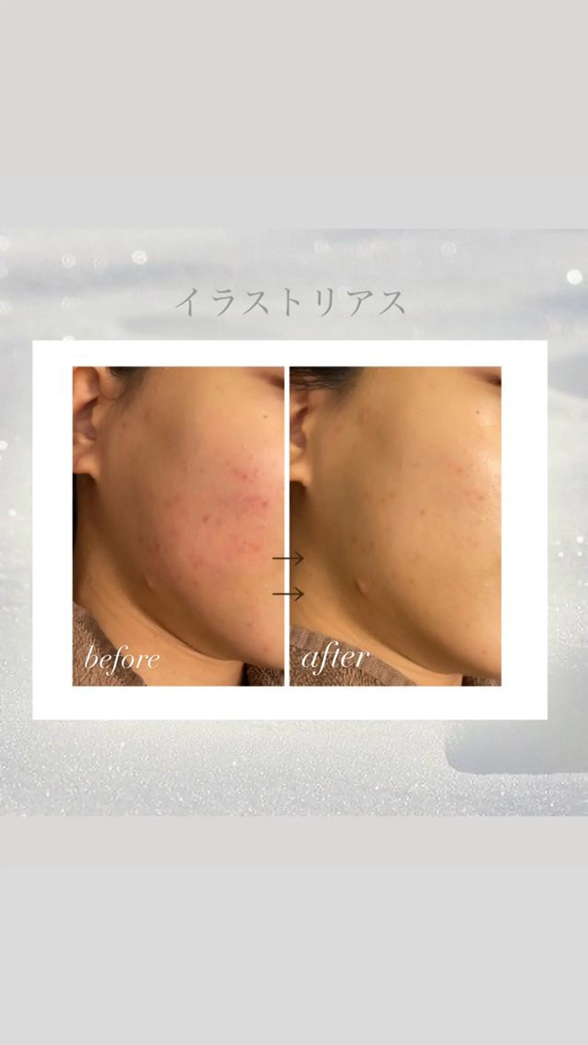 エステ 🦋美肌サロン. maho🦋のエステ・リラクイメージ